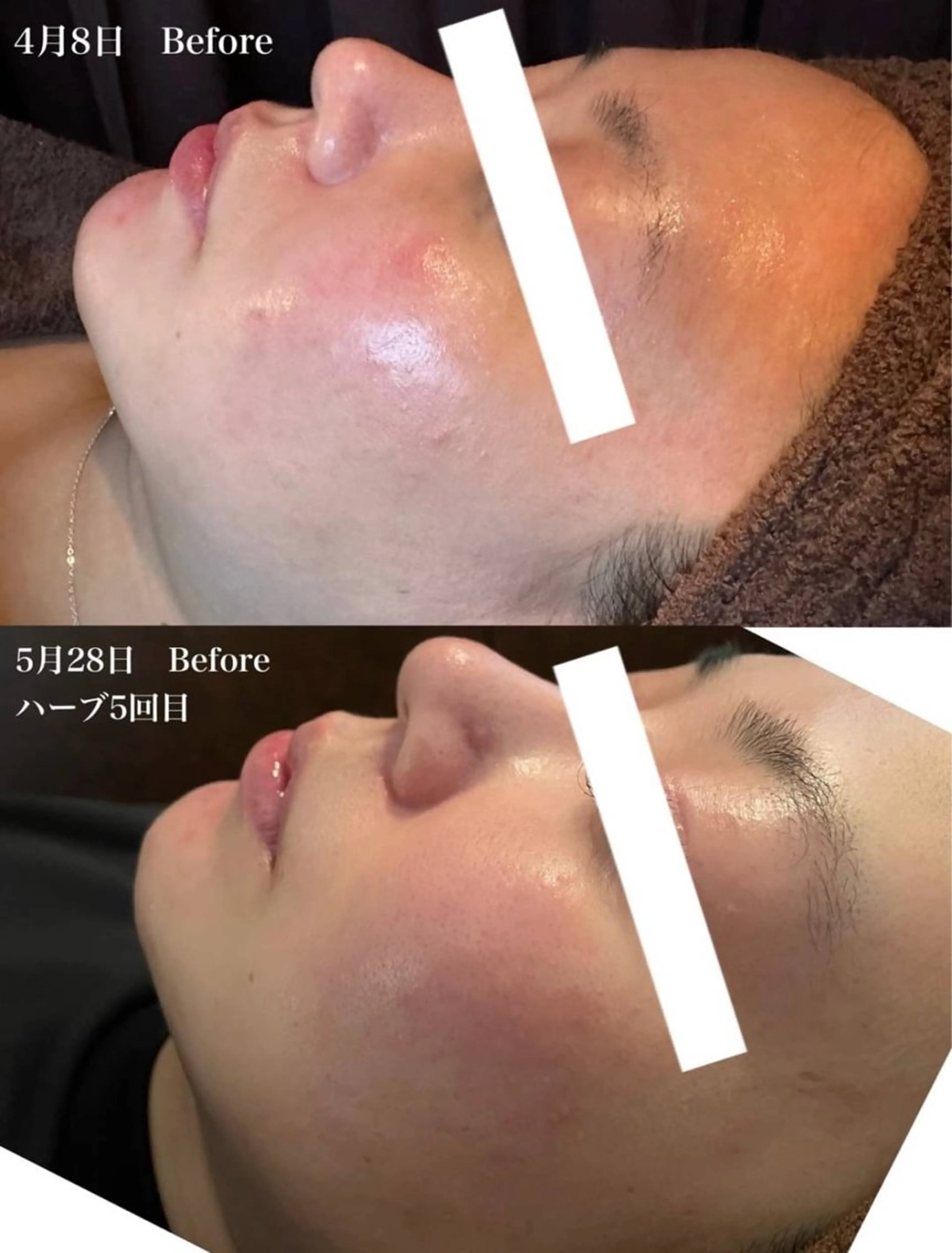 エステ ハイフ・小顔・骨盤 シャングリラのエステ・リラクイメージ