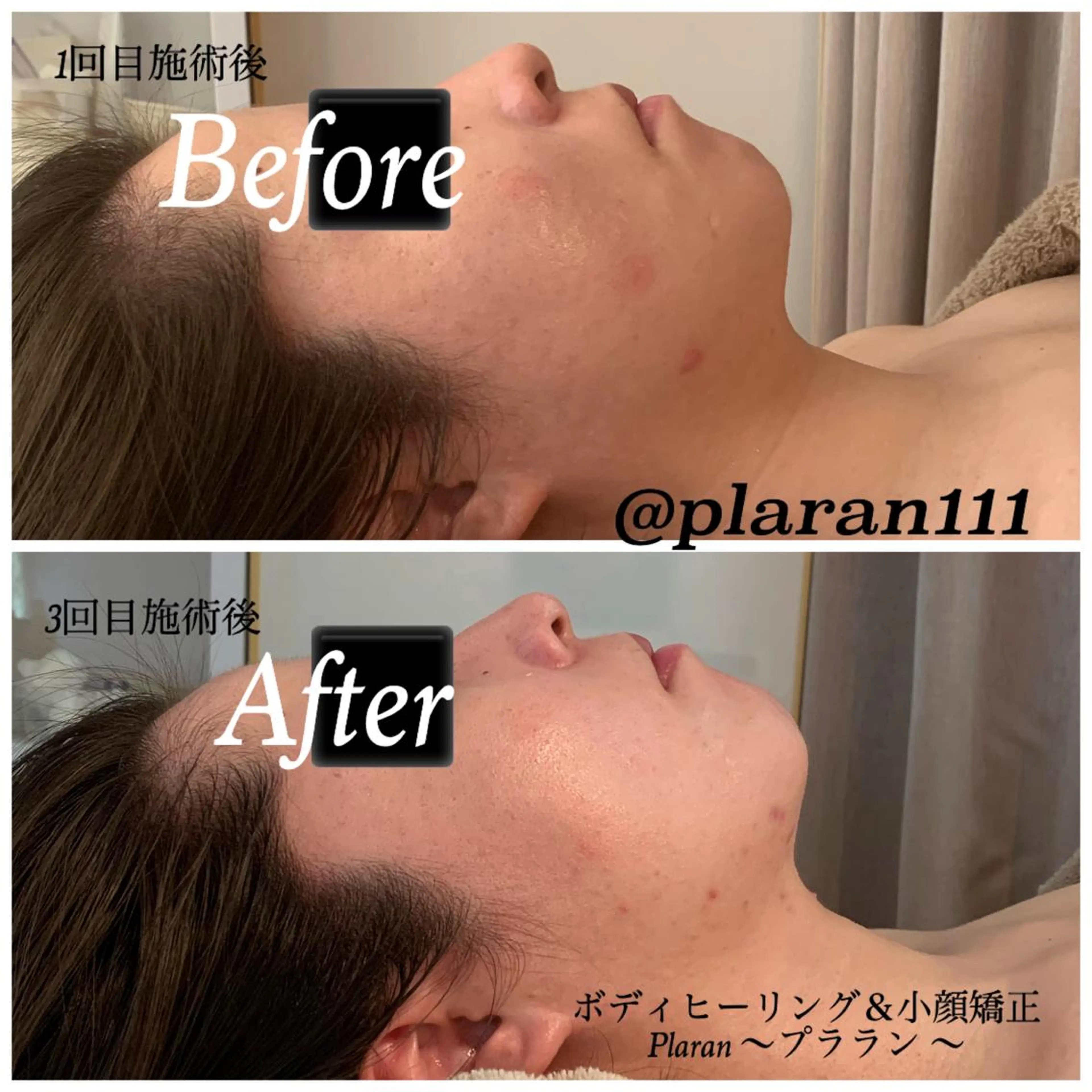 Plaran 〜プララン 〜のその他イメージ