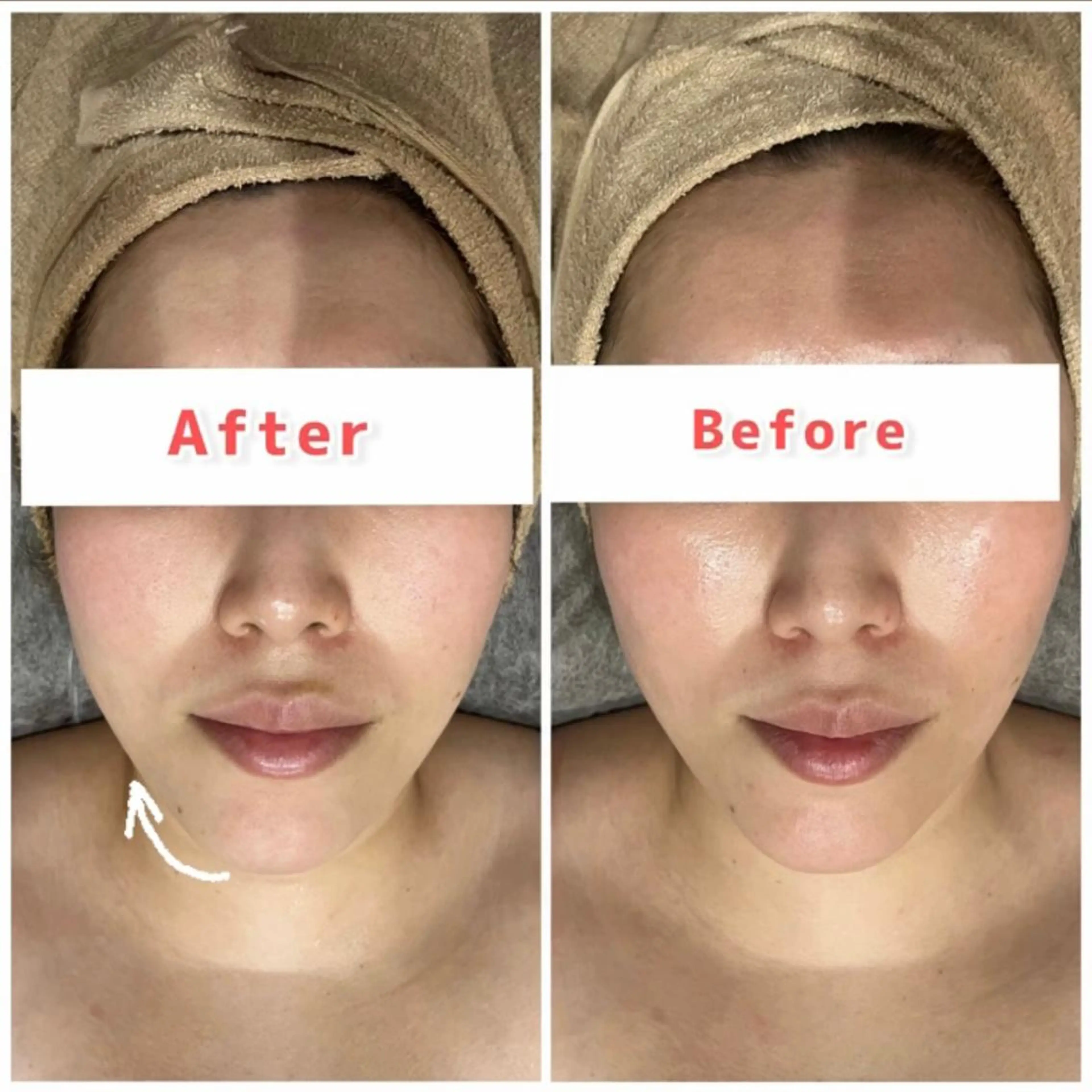 ハーブピーリング専門 muro.のエステ・リラクイメージ