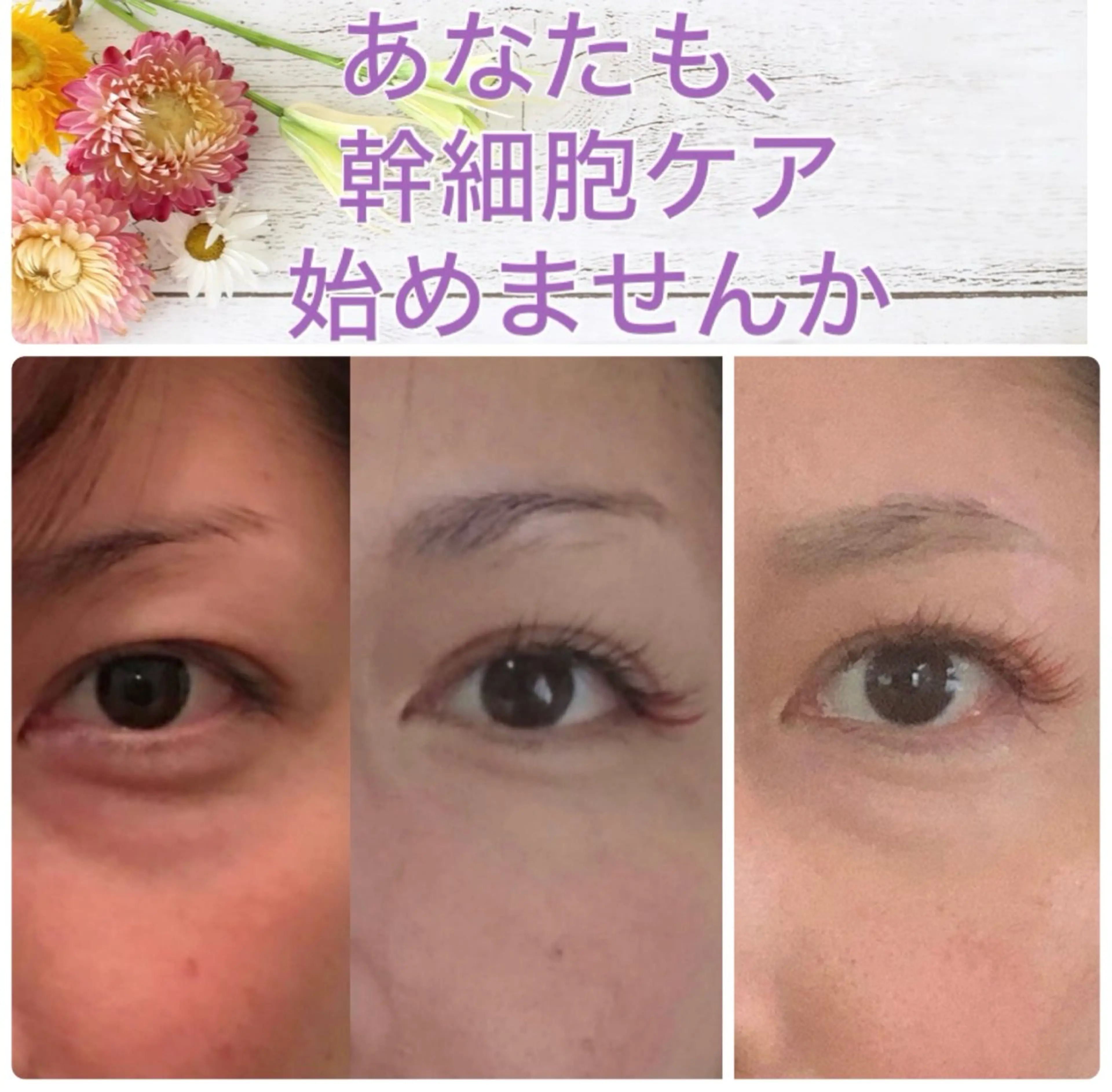 エステ Chura家 幹細胞ケア専門サロンのエステ・リラクイメージ