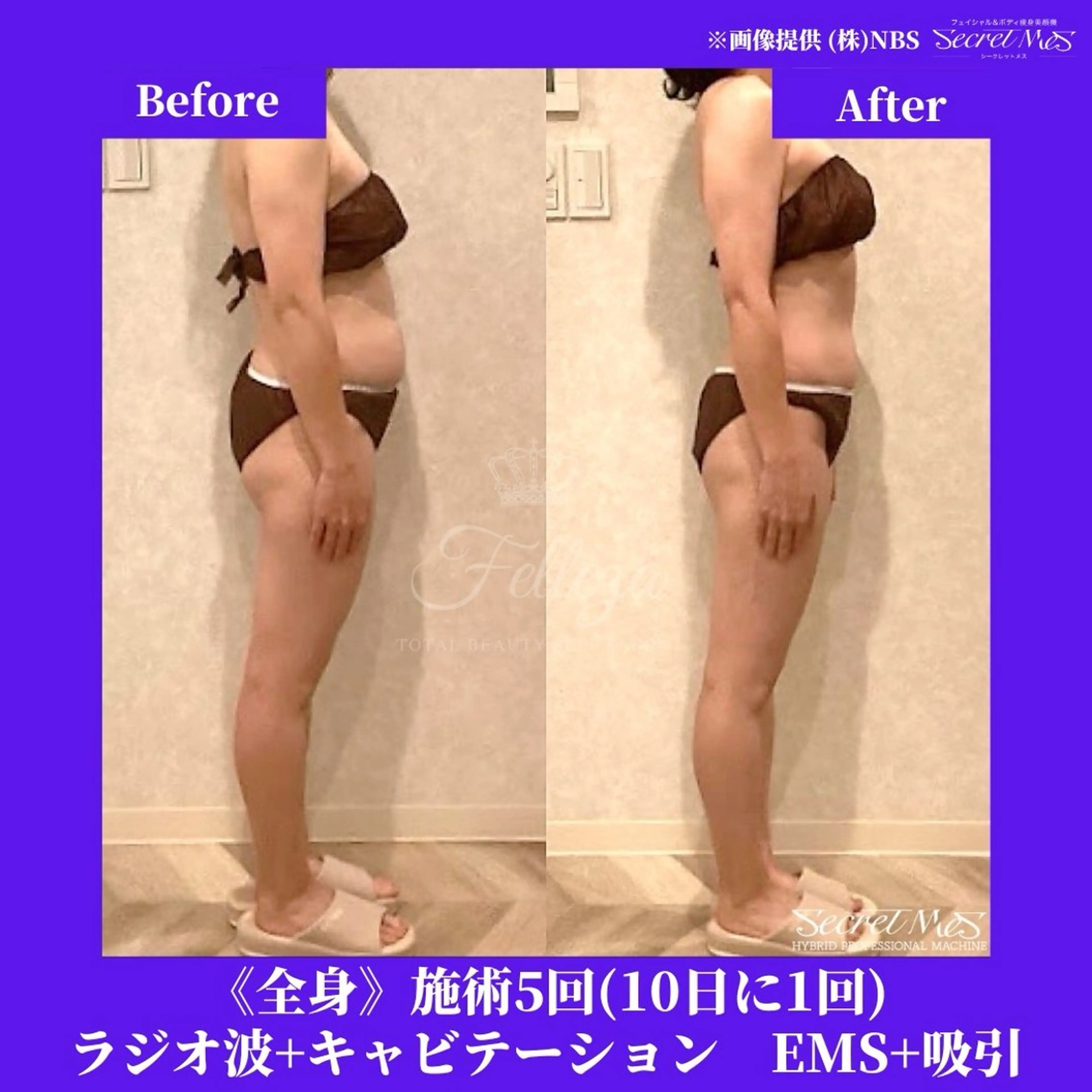 メンズ 有人型セルフサロン 脱毛／痩身／美顔のその他イメージ