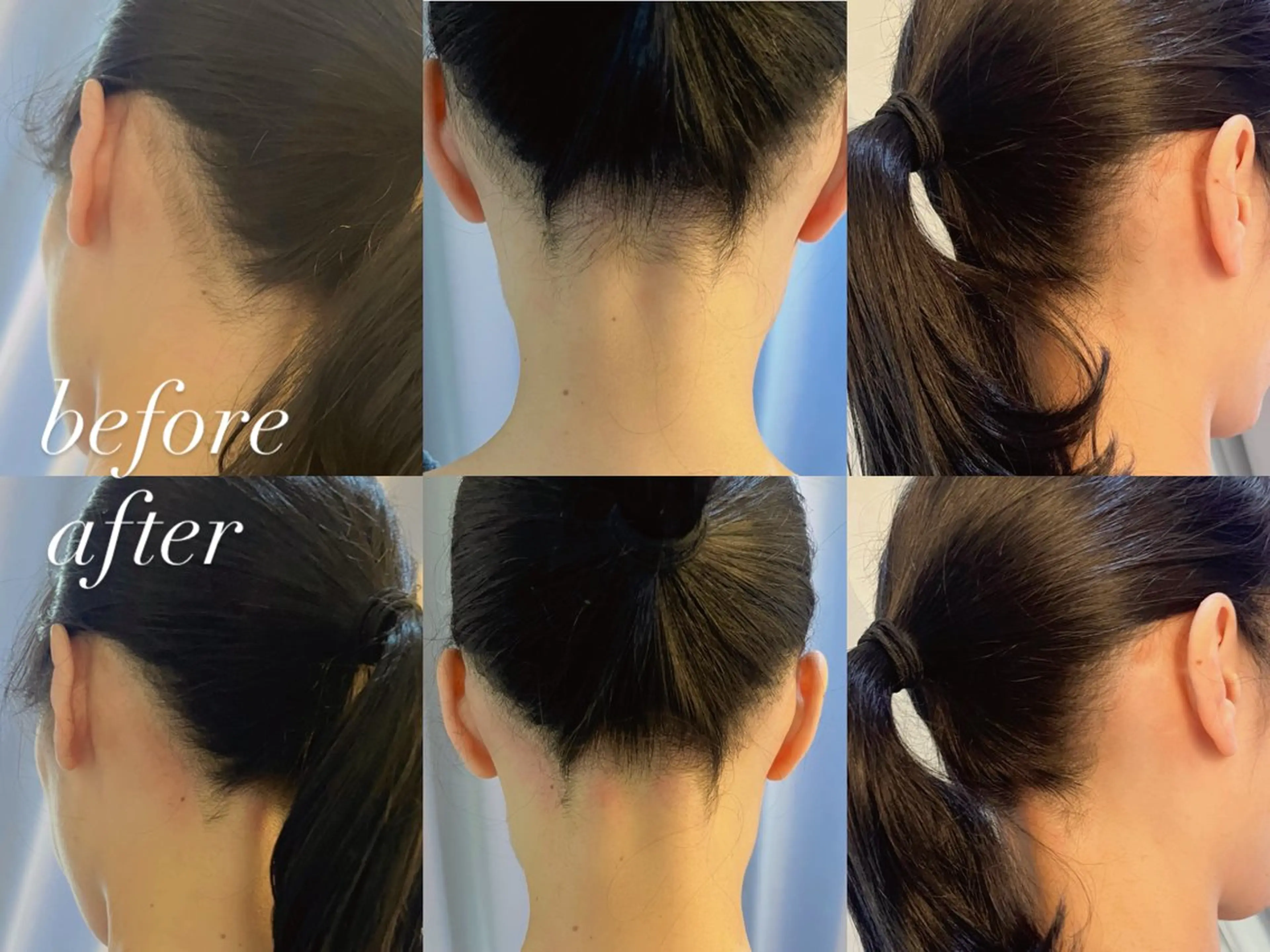 うなじ脱毛/美肌脱毛 LABELのエステ・リラクイメージ