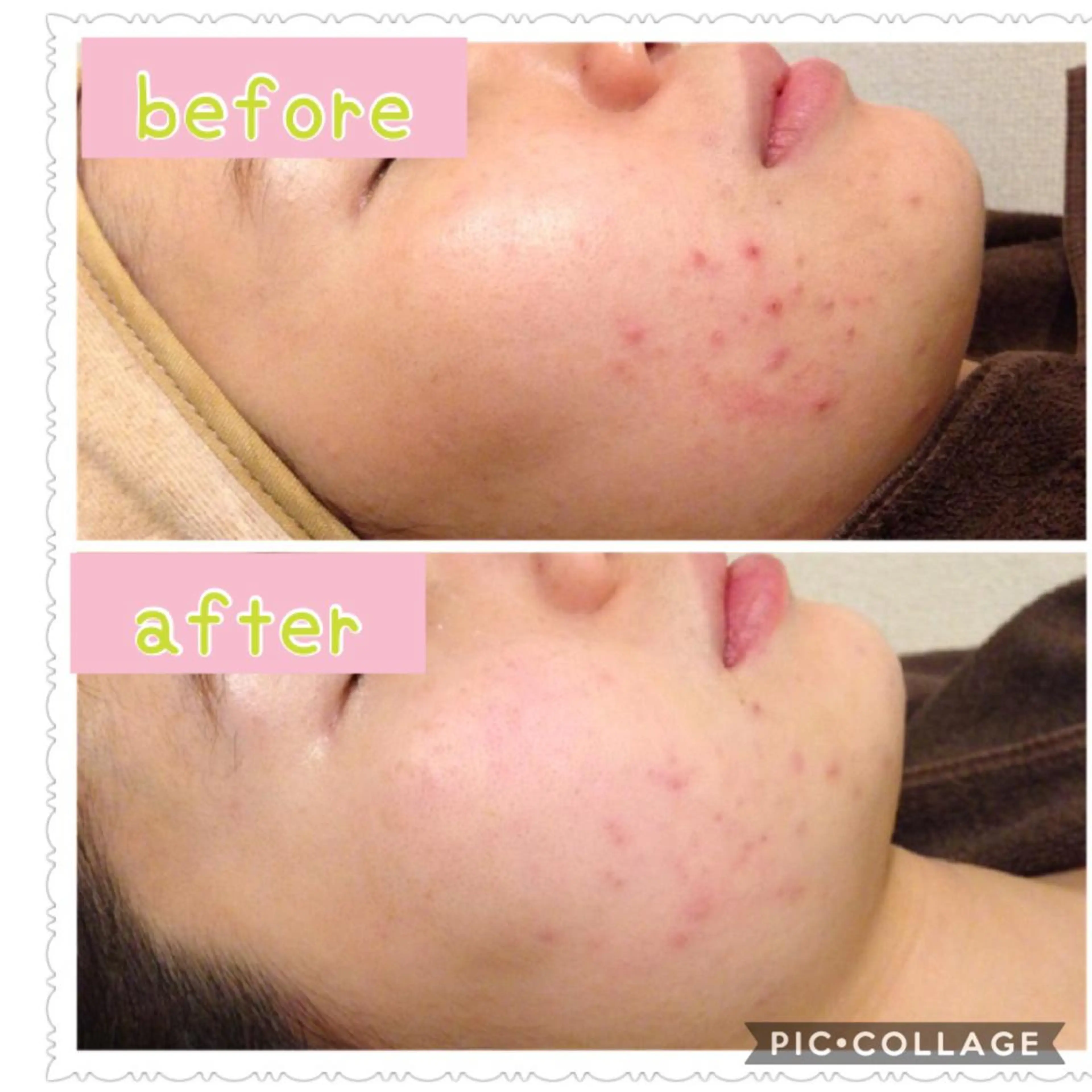 癒し腸もみサロン シャユーム　ゆきなのエステ・リラクイメージ