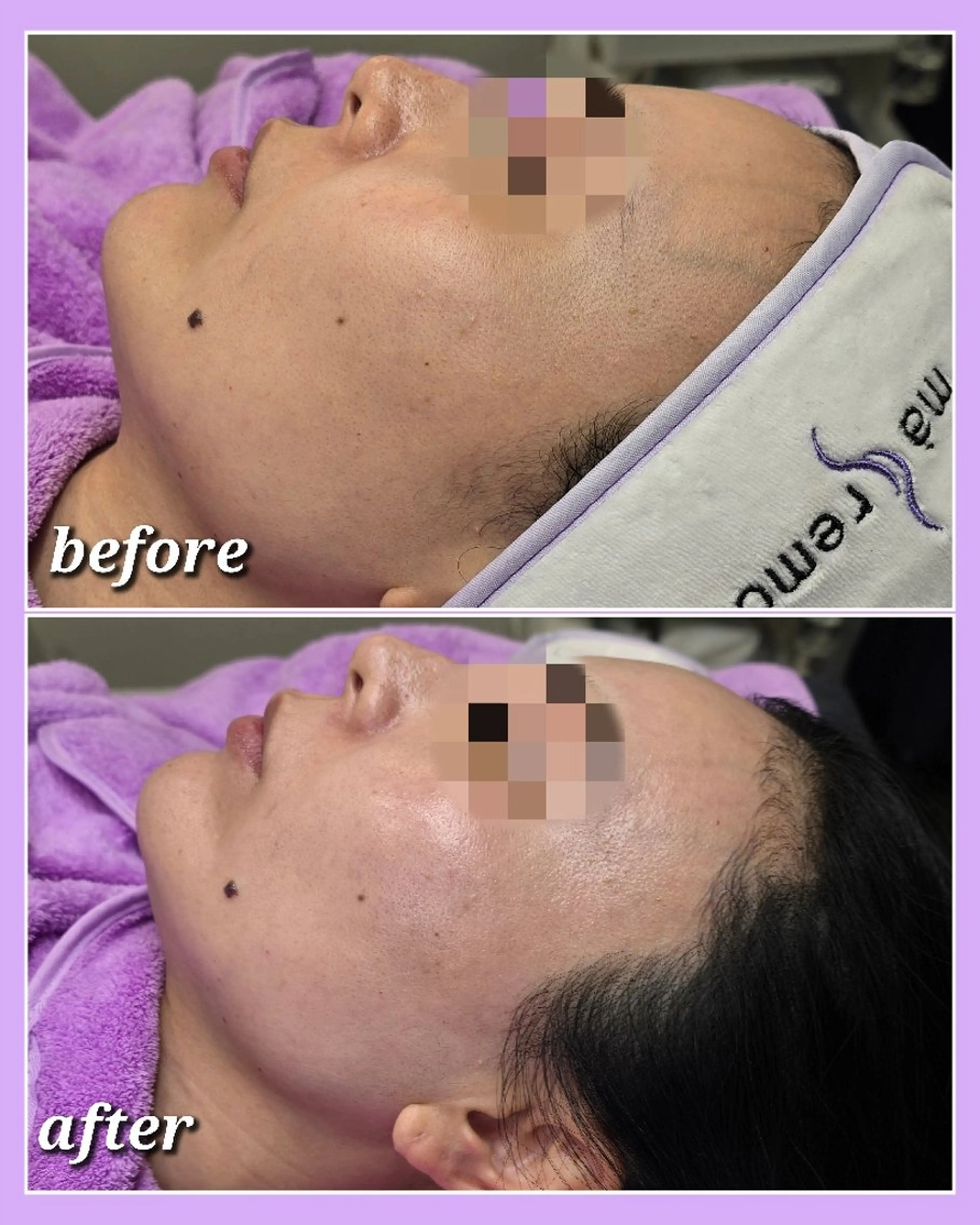 エステ facial salon Lily所属・salon Lilyのエステ・リラクイメージ