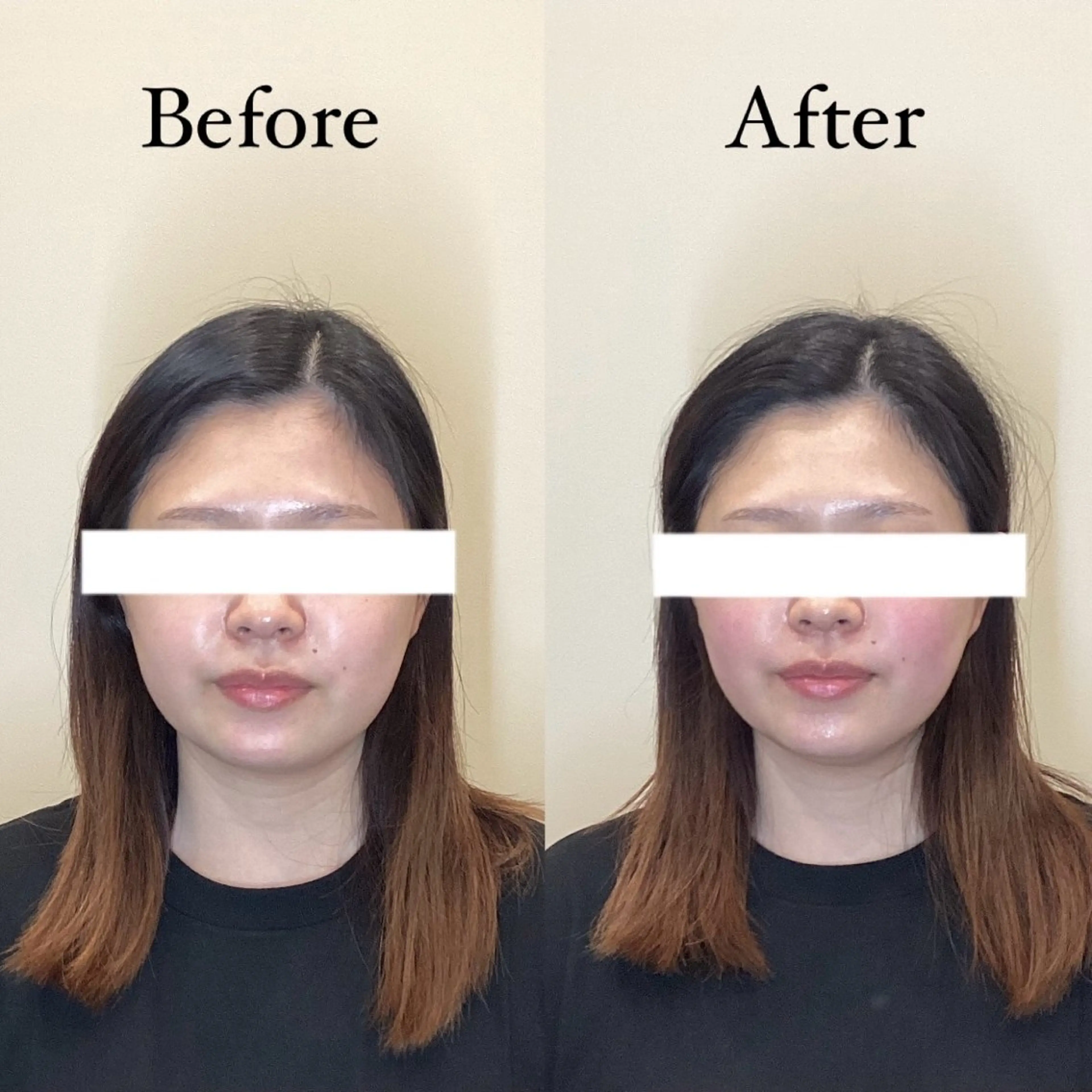 エステ リラク Hari Lounge　梅田所属・seika🍒 ハリラウンジ梅田のエステ・リラクイメージ