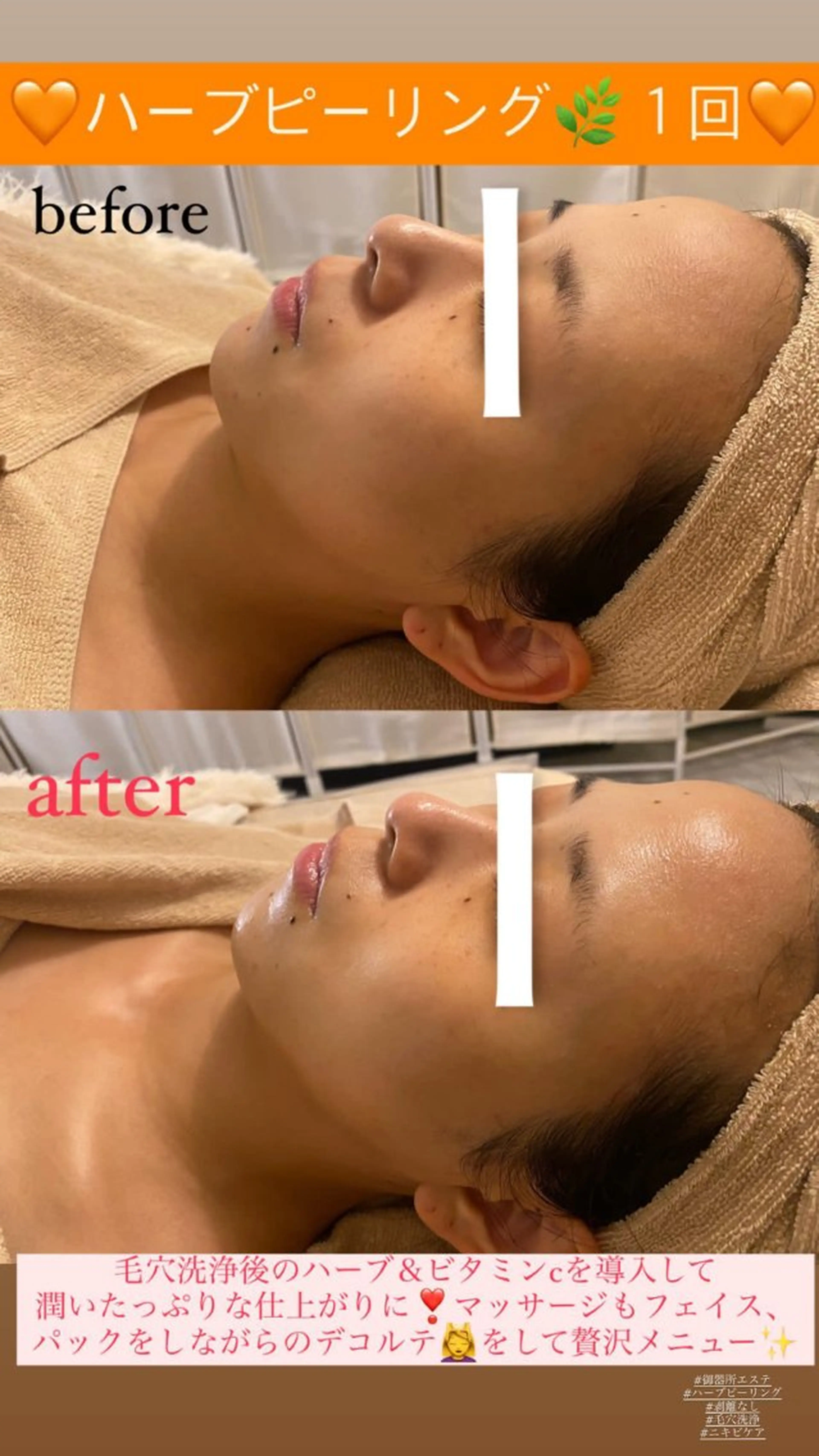 エステ Salon de Lino 御器所のエステ・リラクイメージ