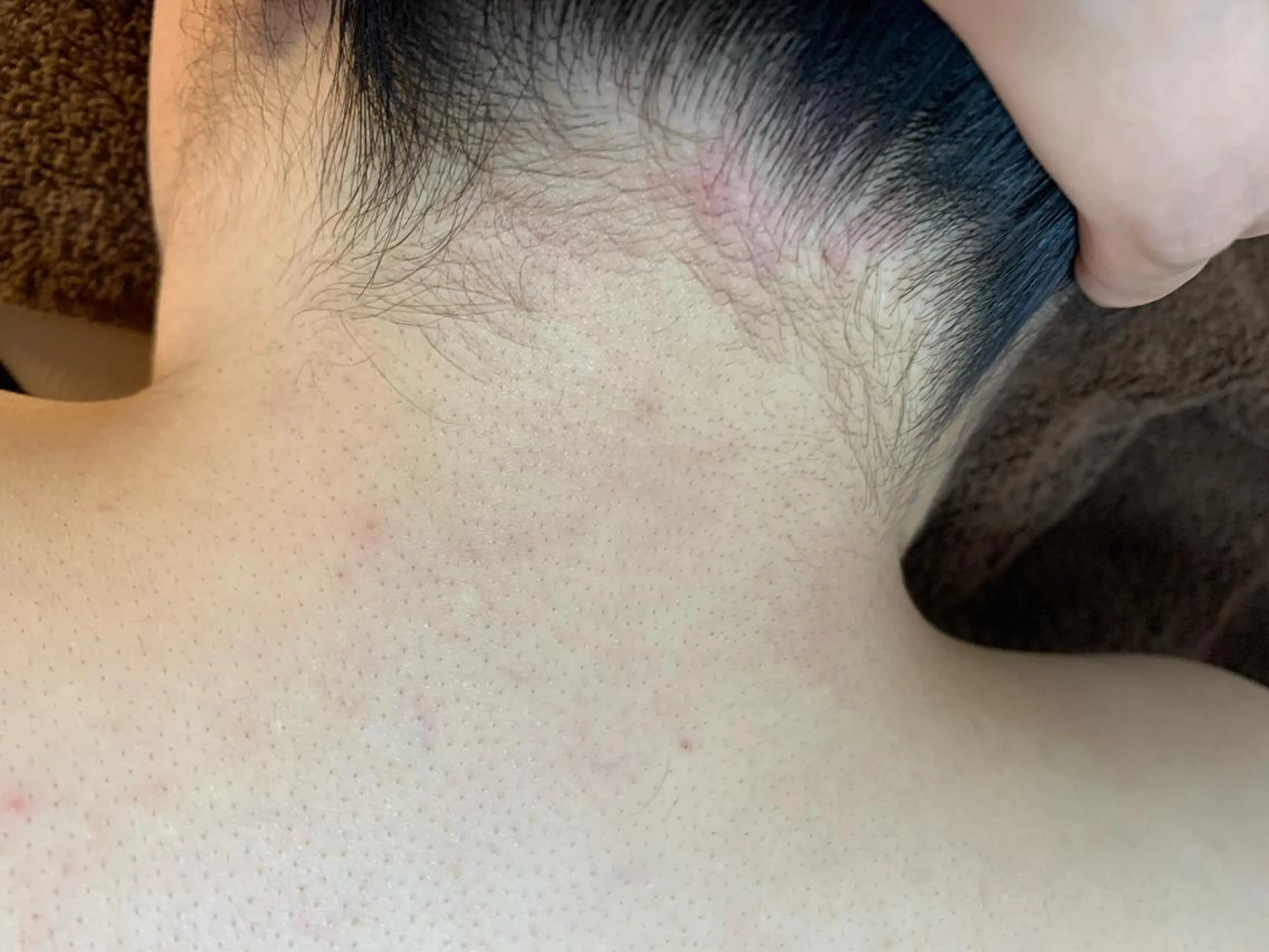 脱毛SALON RaYNiCKのエステ・リラクイメージ