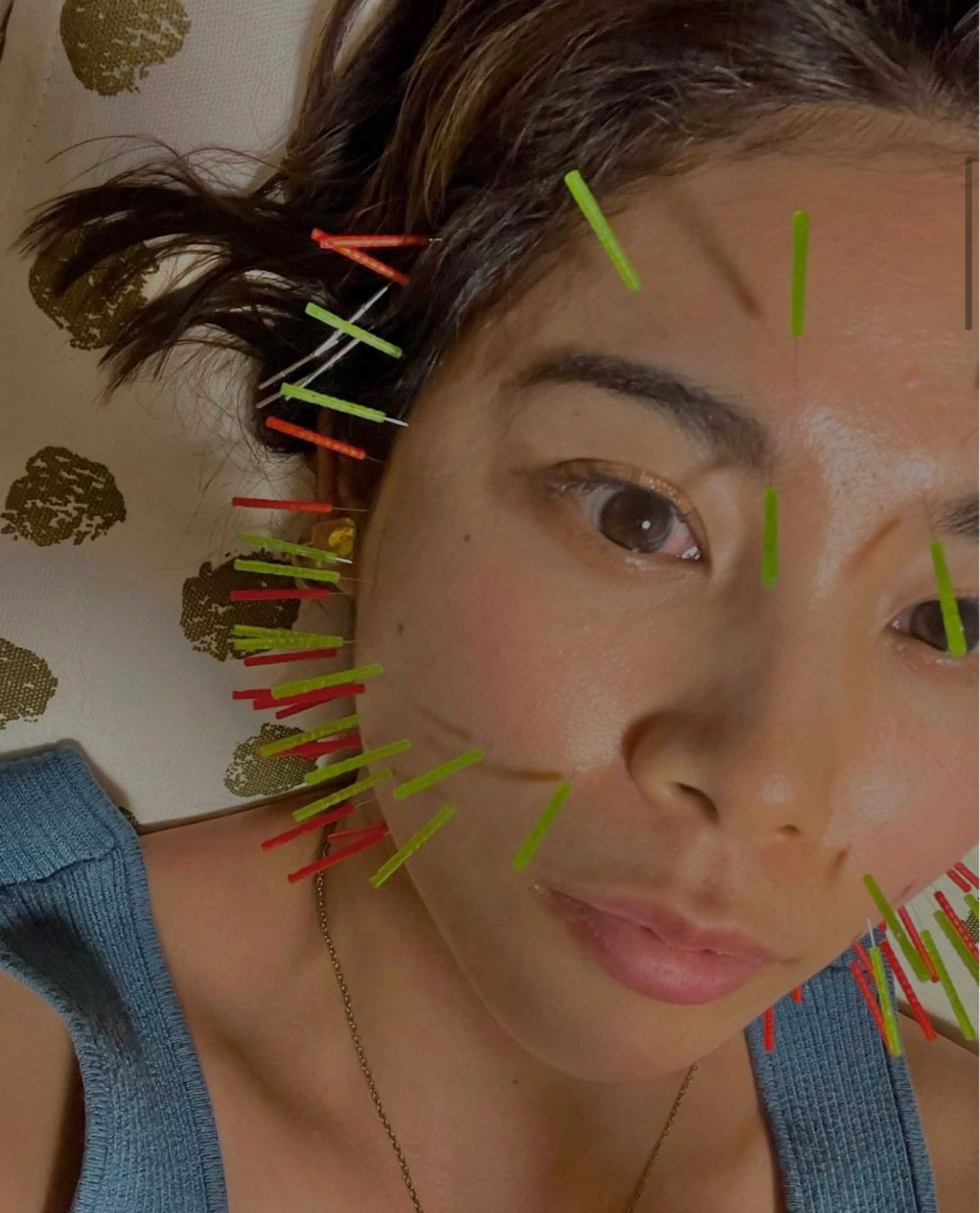 THE  ROOTS所属・美容鍼♡小顔矯正♡ fumikaのエステ・リラクイメージ