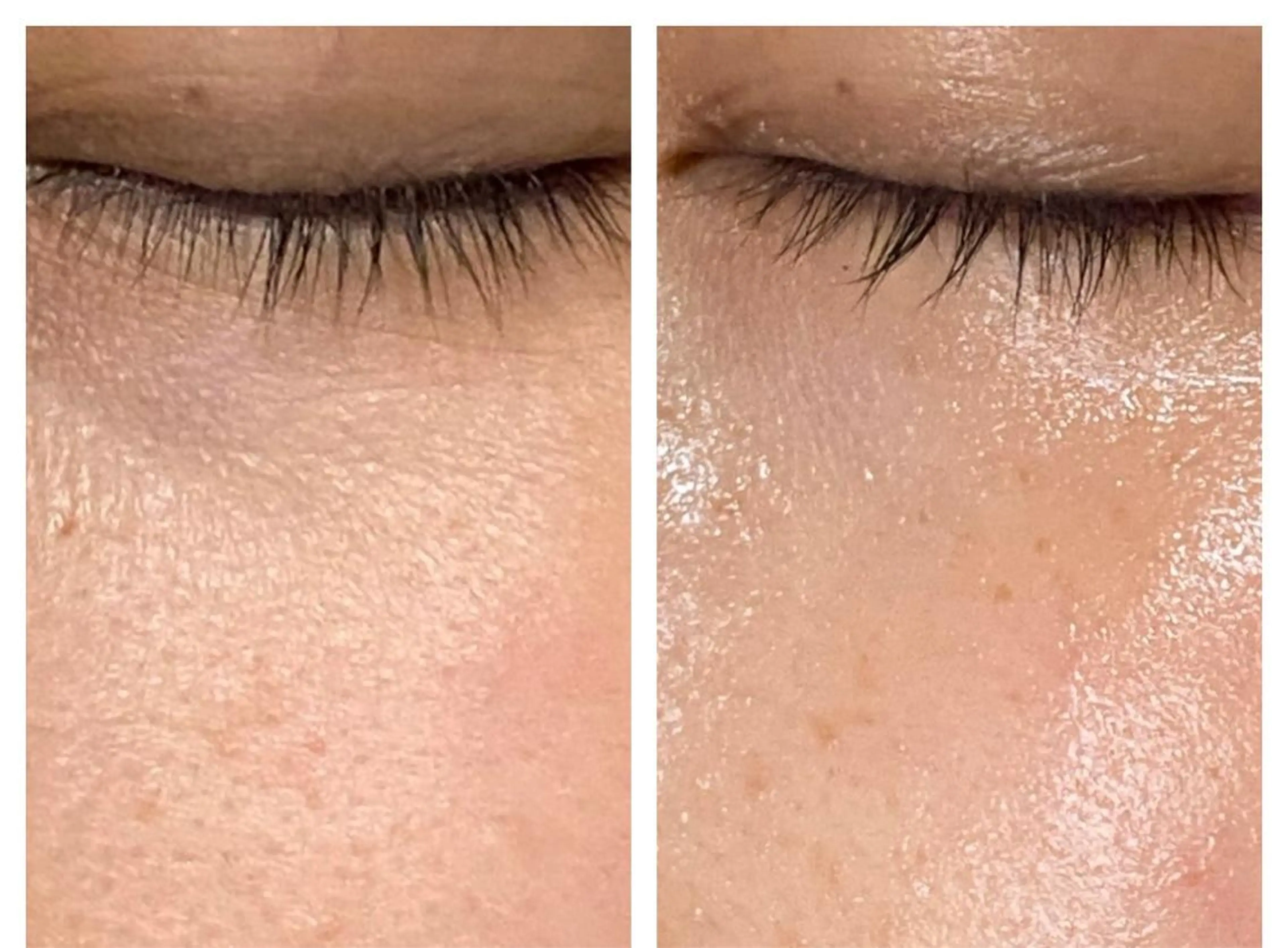 salon.plaisir（プレズィール）所属・酒井 瑠未のエステ・リラクイメージ