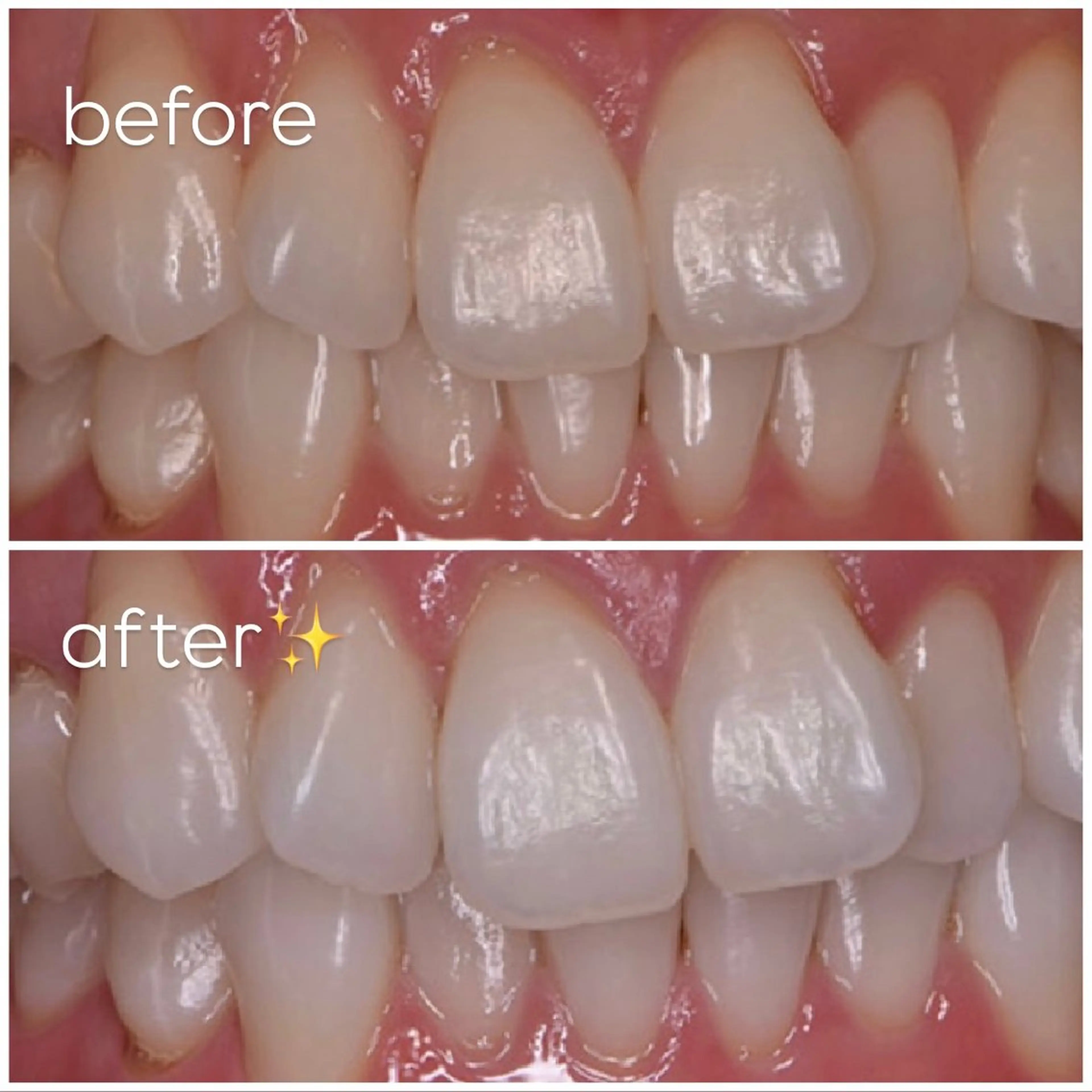 エクシア津駅前店所属・セルフホワイトニング エクシア津駅前店のその他イメージ