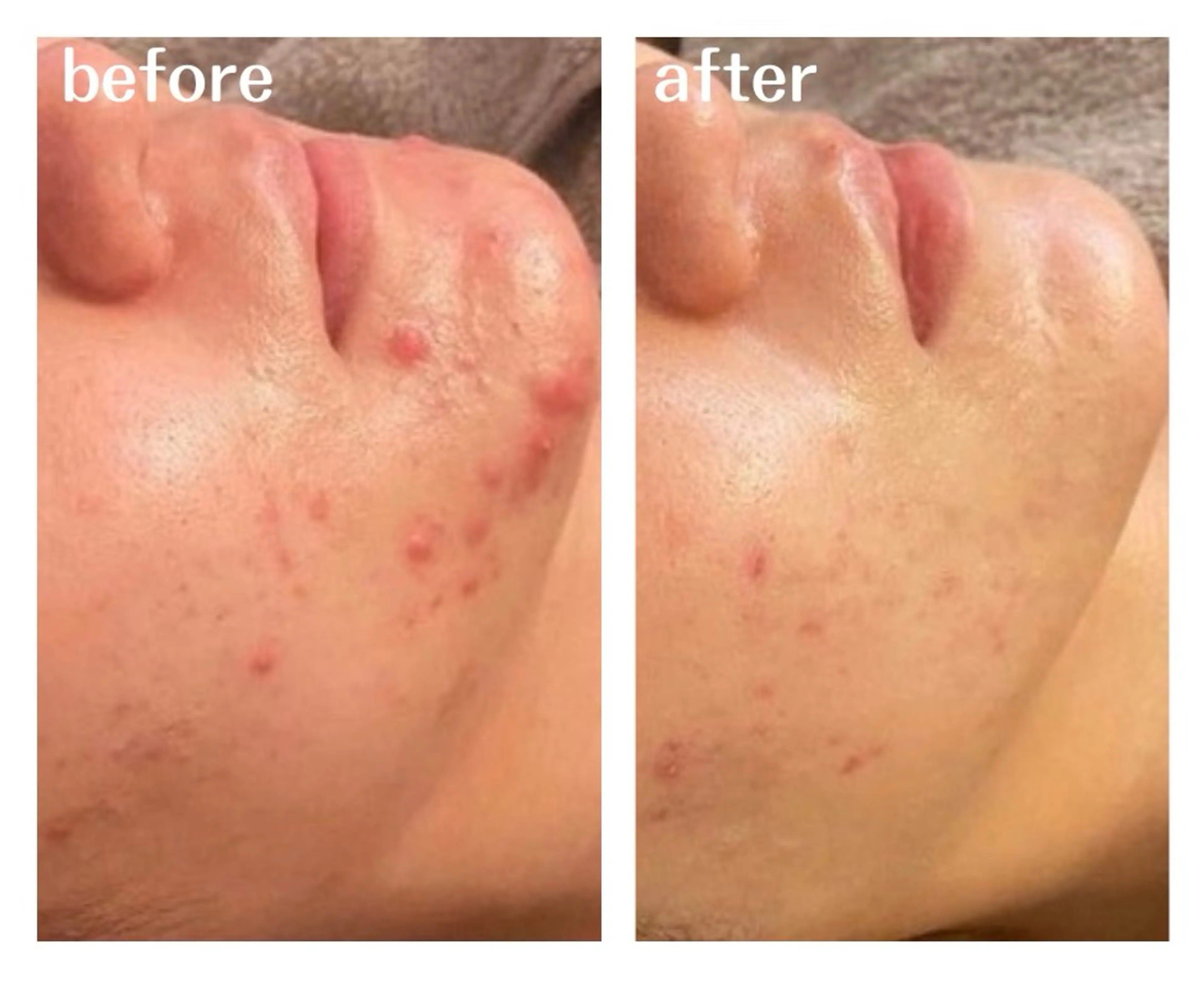 エステ aimee　肌質改善サロン【アイミー】所属・肌質改善サロン aimee｜アイミーのエステ・リラクイメージ