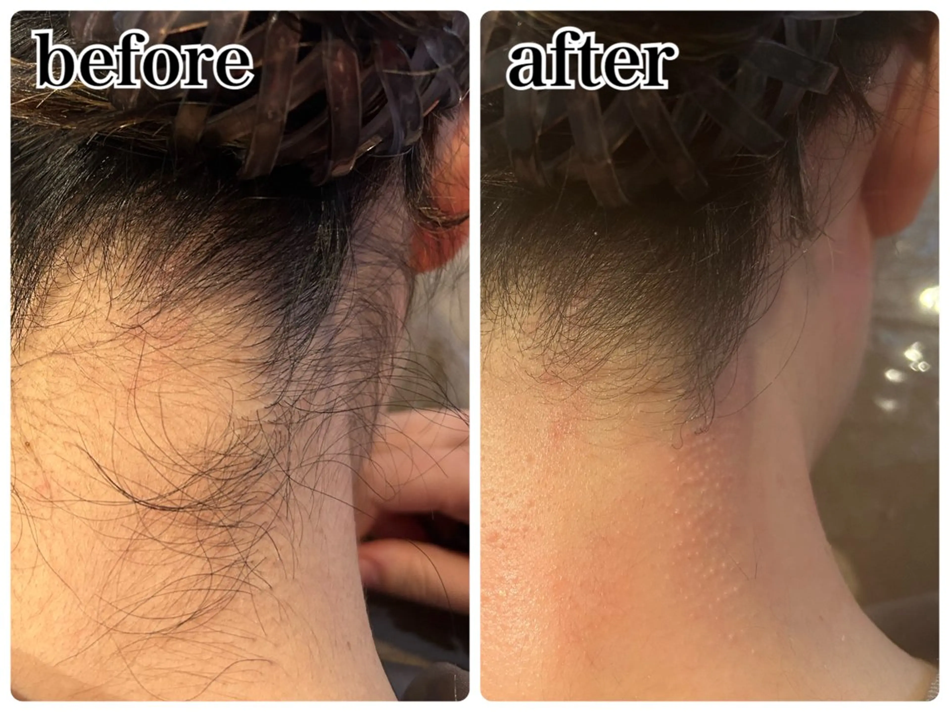 脱毛 Gemini 　MIKIのエステ・リラクイメージ