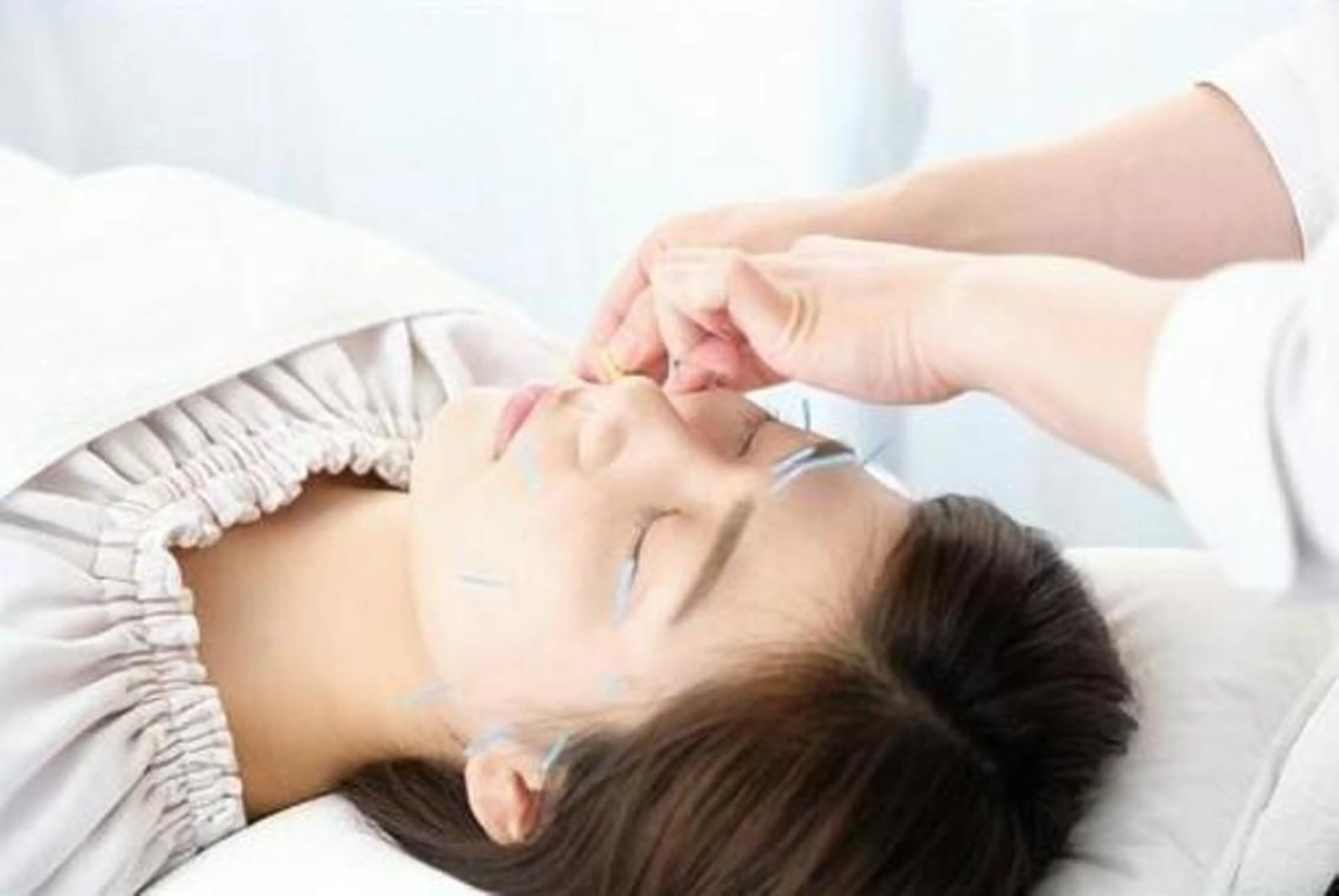 鍼ボディケア＋美顔鍼コースの写真