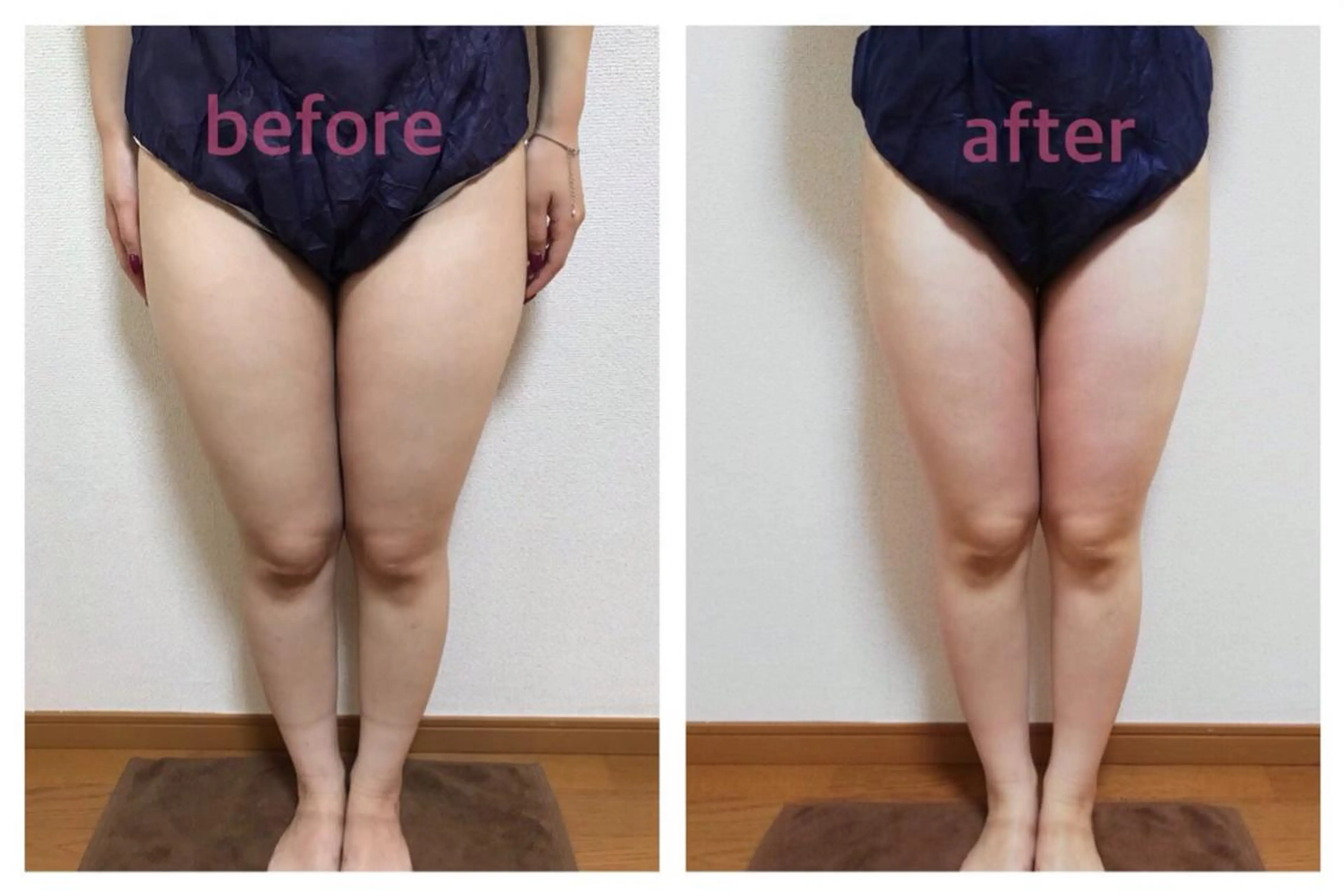 biloop所属・《痩身×疲労改善》 BILOOPのエステ・リラクイメージ