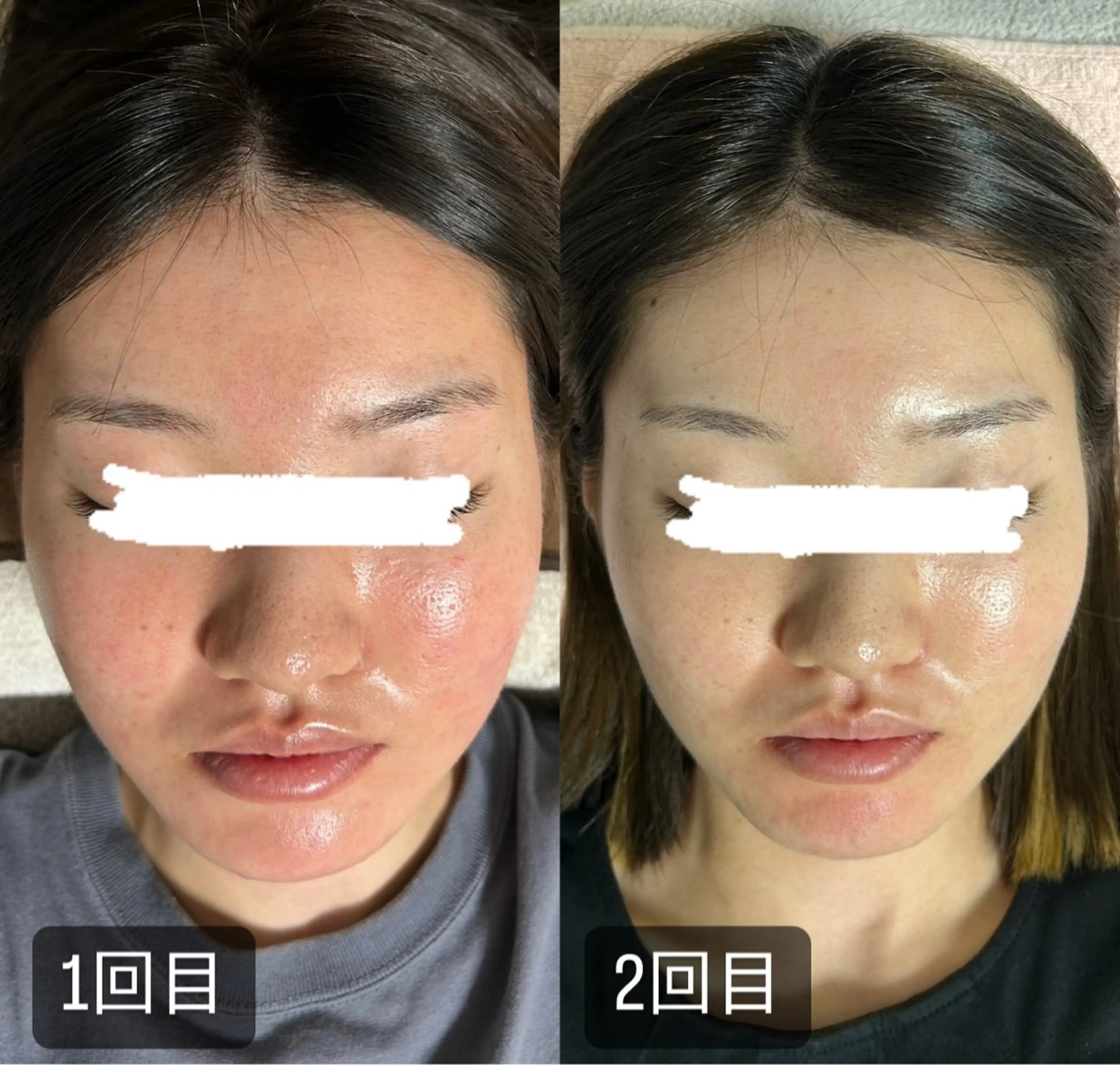 217whitening  room所属・217 ホワイトニングルームのエステ・リラクイメージ