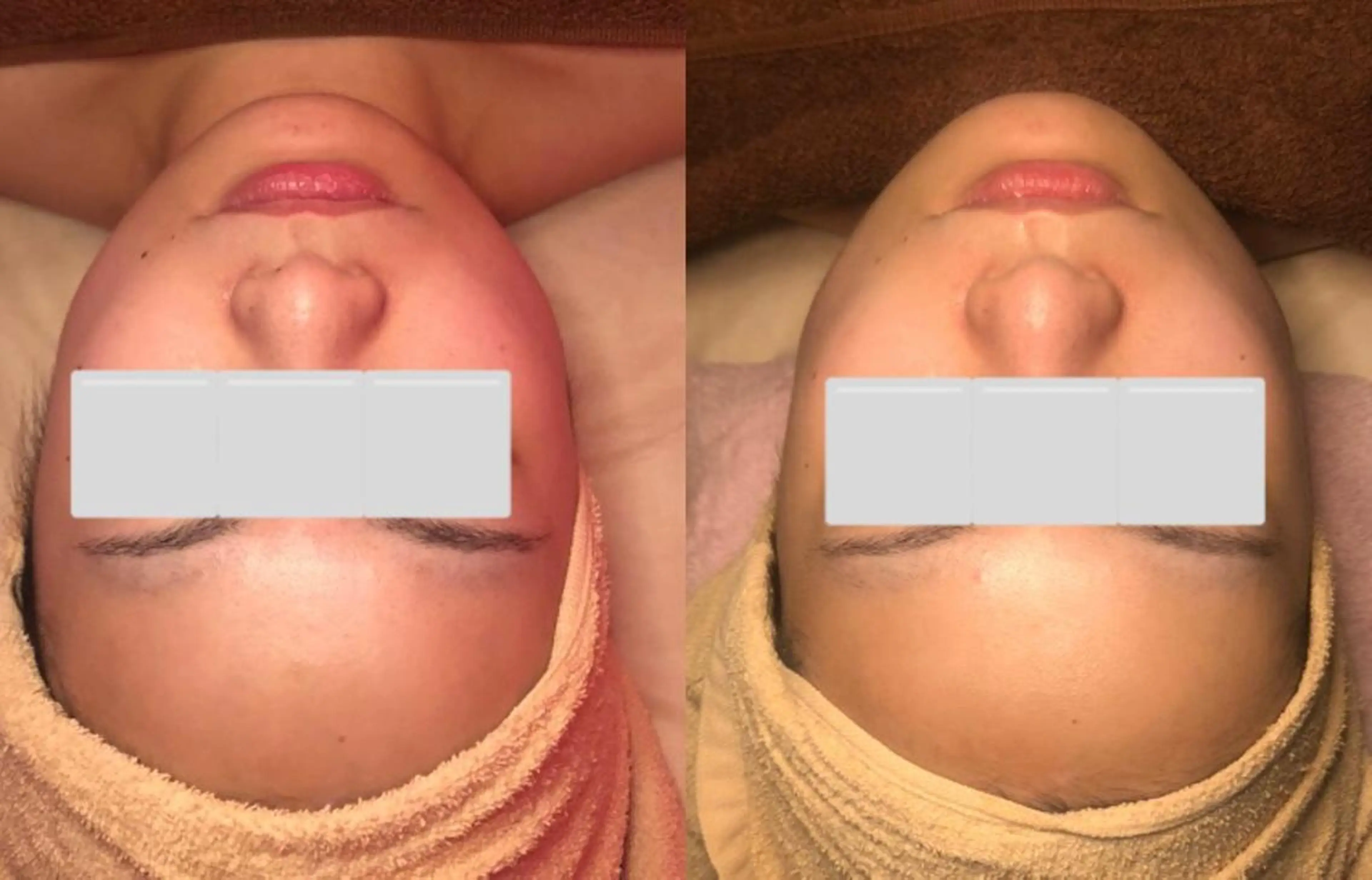 a  room salonのエステ・リラクイメージ