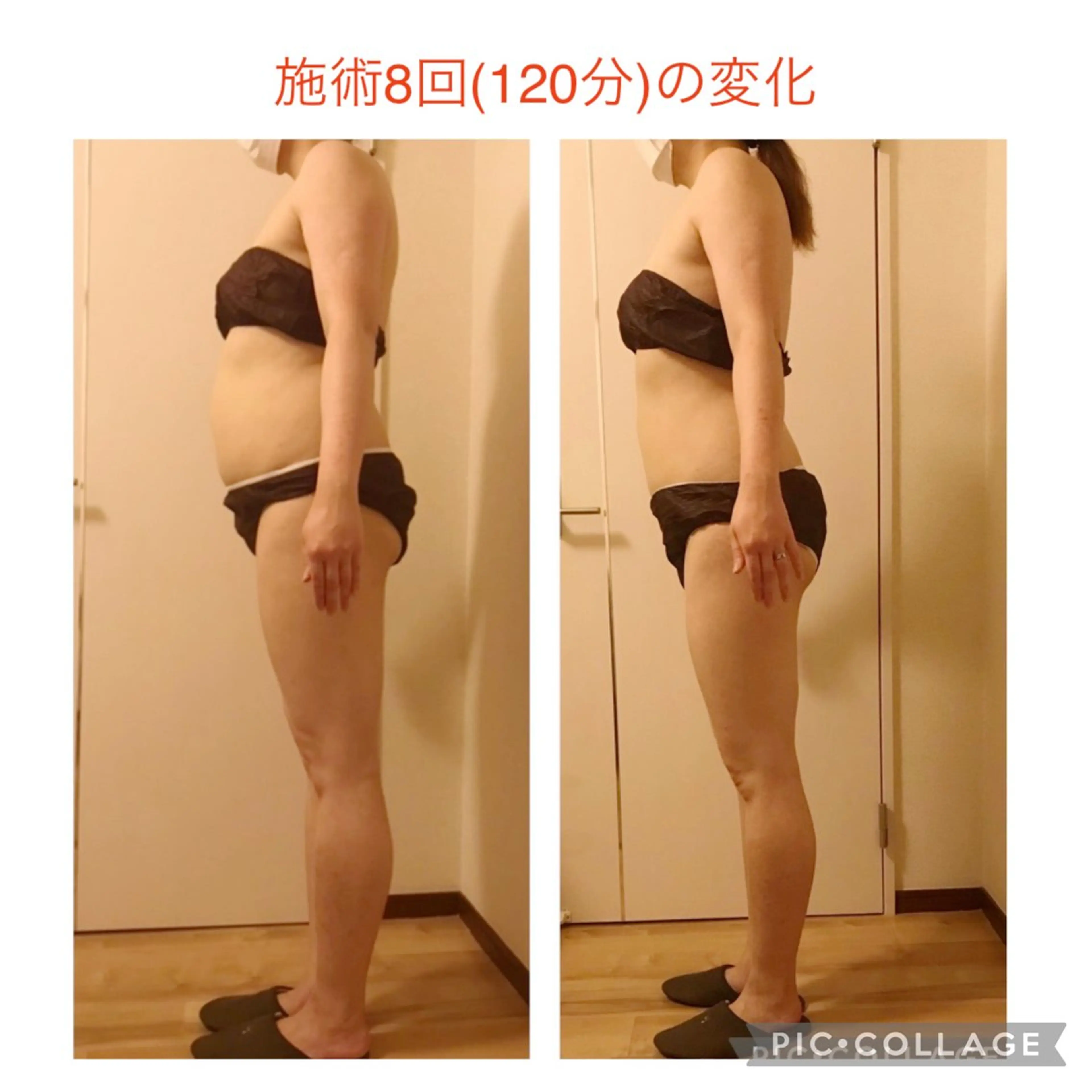 🌸人気No.1！🌸一度で本気の美ボディ🌟下半身特化コース150分の写真