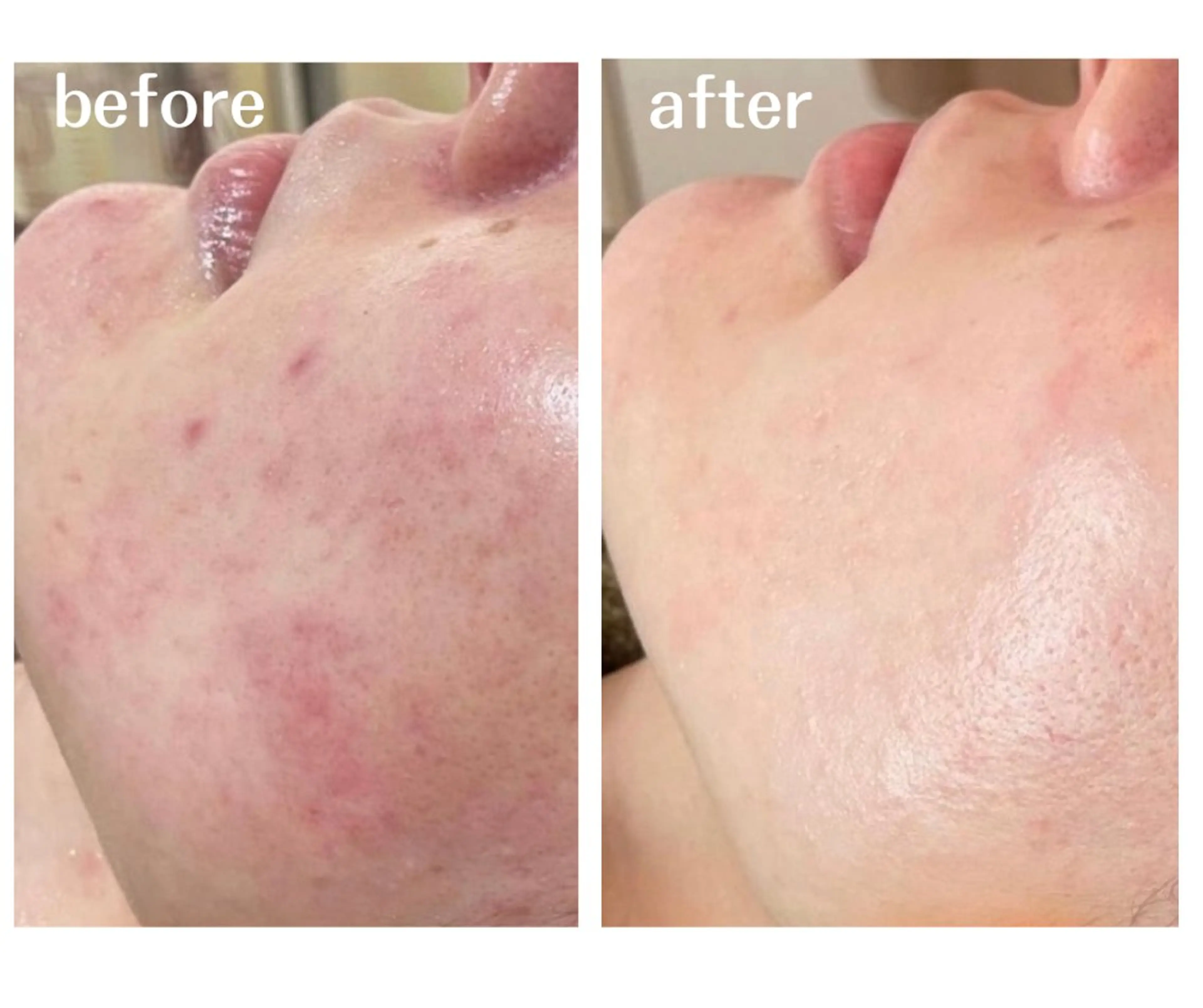 エステ aimee　肌質改善サロン【アイミー】所属・肌質改善サロン aimee｜アイミーのエステ・リラクイメージ