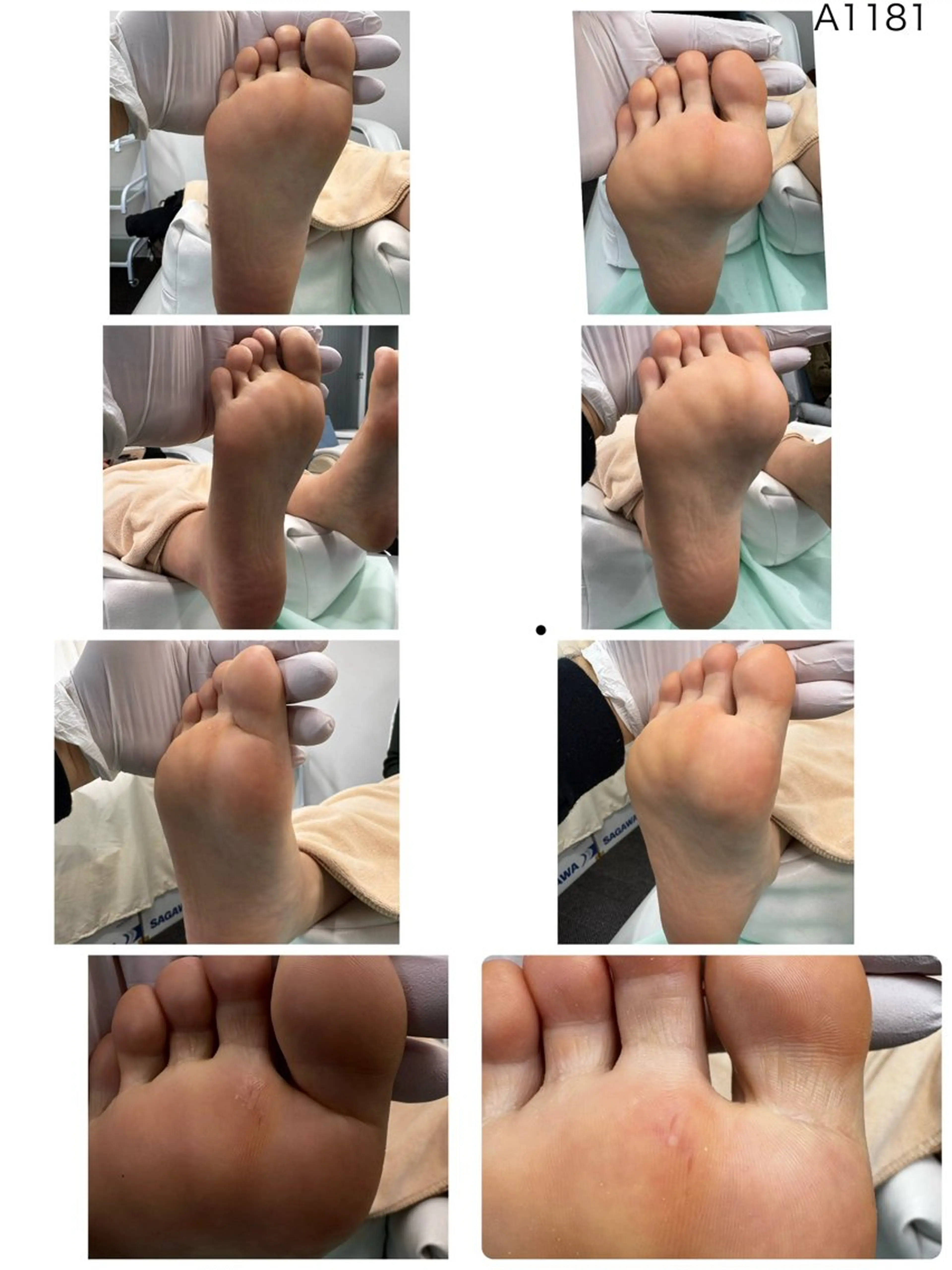 リラク 巻き爪補正店枚方店所属・松本 猛史のネイルデザイン