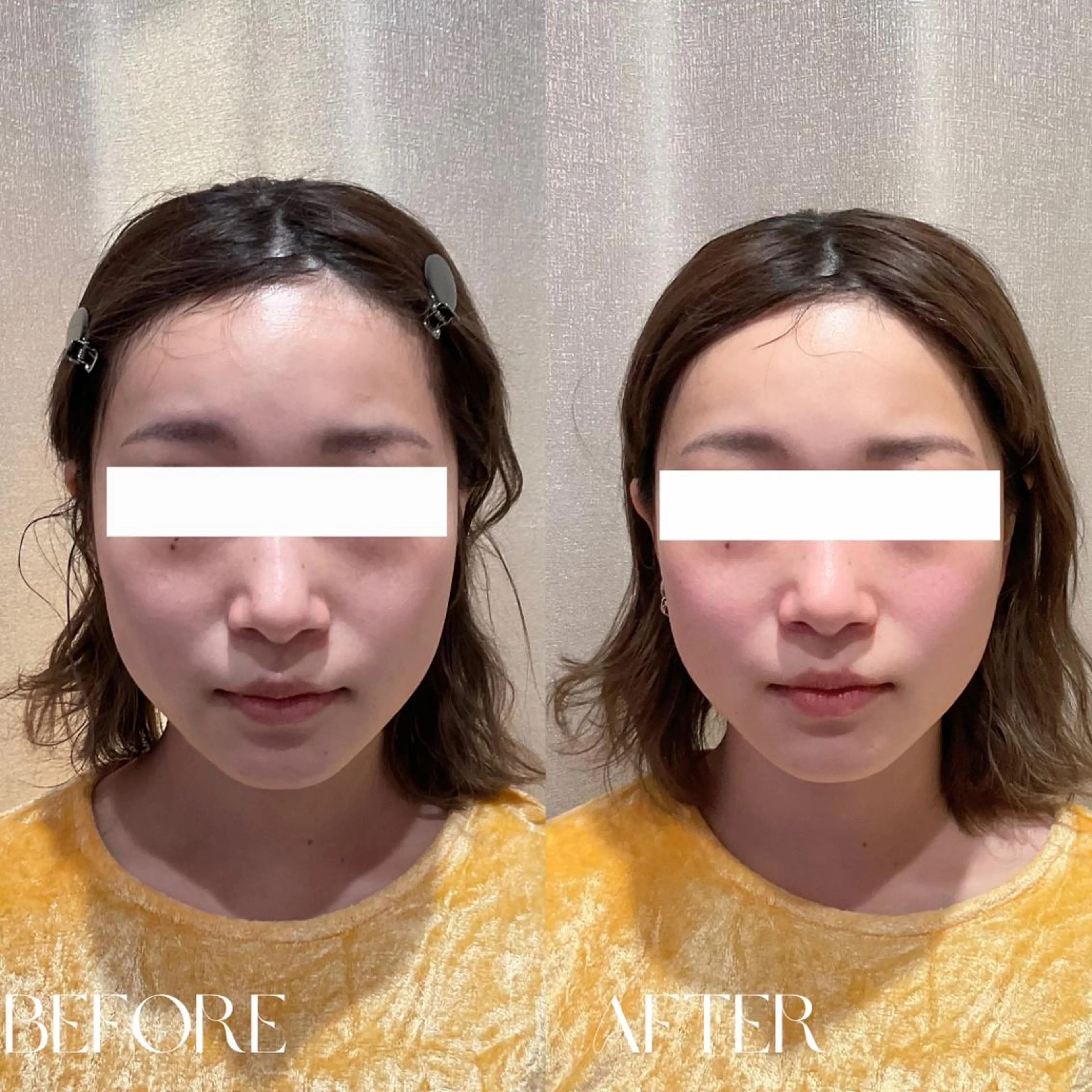 エステ リラク B-st. 下北沢のエステ・リラクイメージ