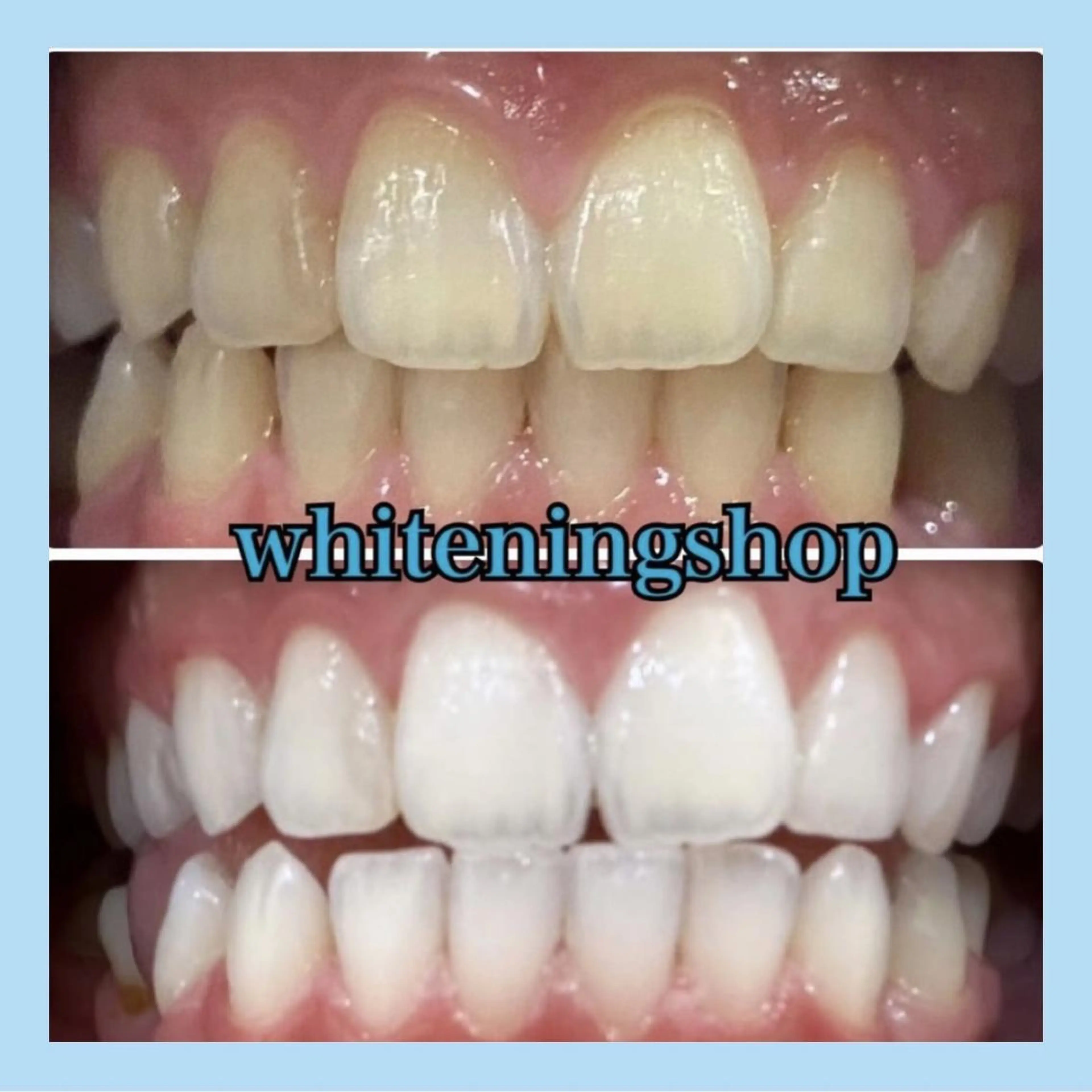 ホワイトニング ショップ千葉店のその他イメージ