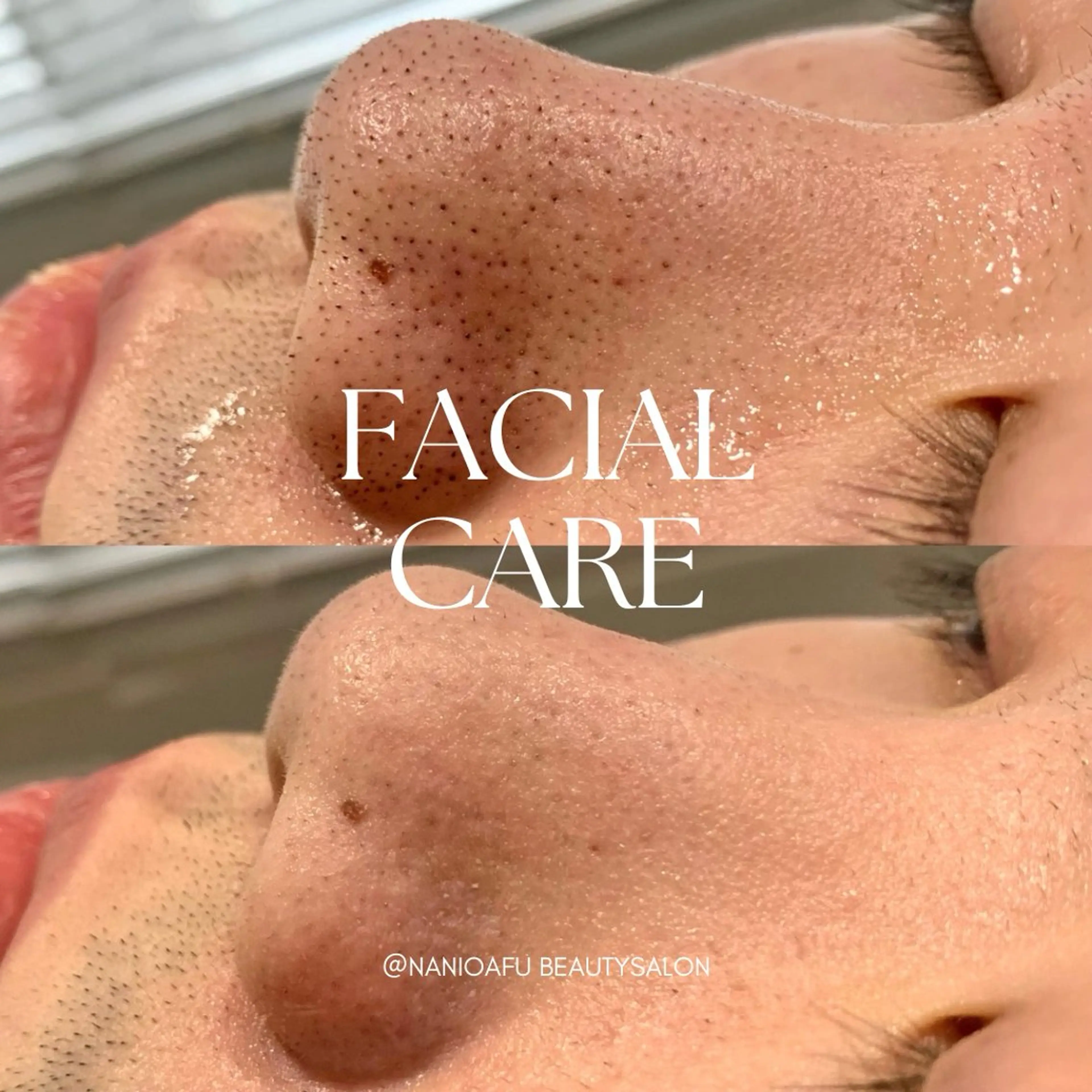 メンズ キッズ エステ リラク NANI OAFU所属・NANIOAFU [なんば店］のその他イメージ