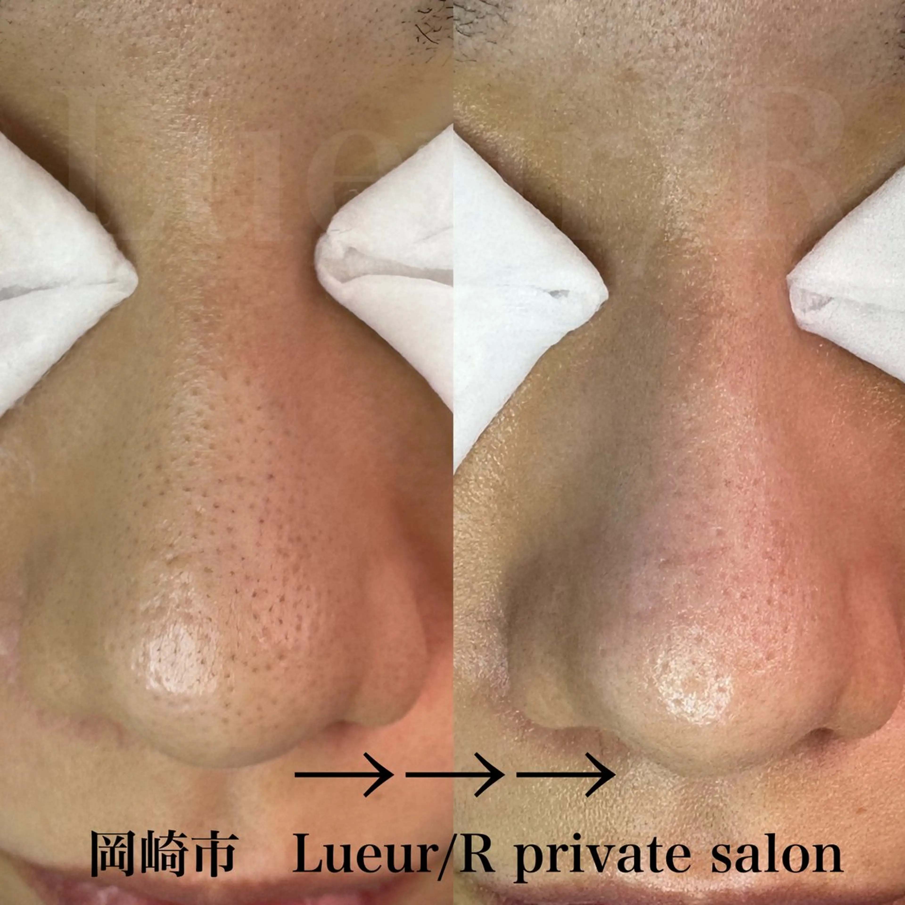 エステ 大久保 里奈のエステ・リラクイメージ