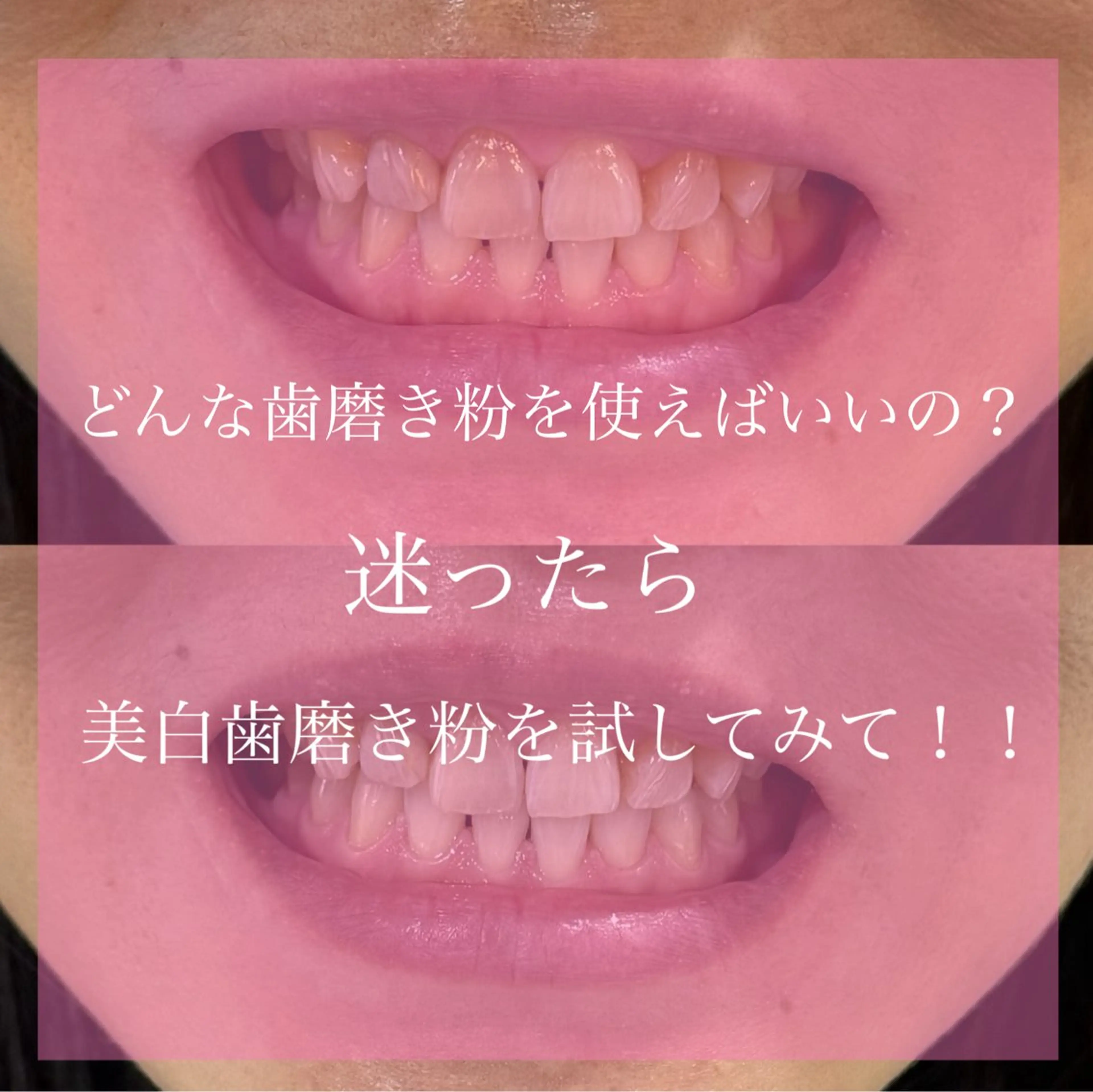 その他 Livicate 💗🧁🎀🦋のマツエク・マツパデザイン