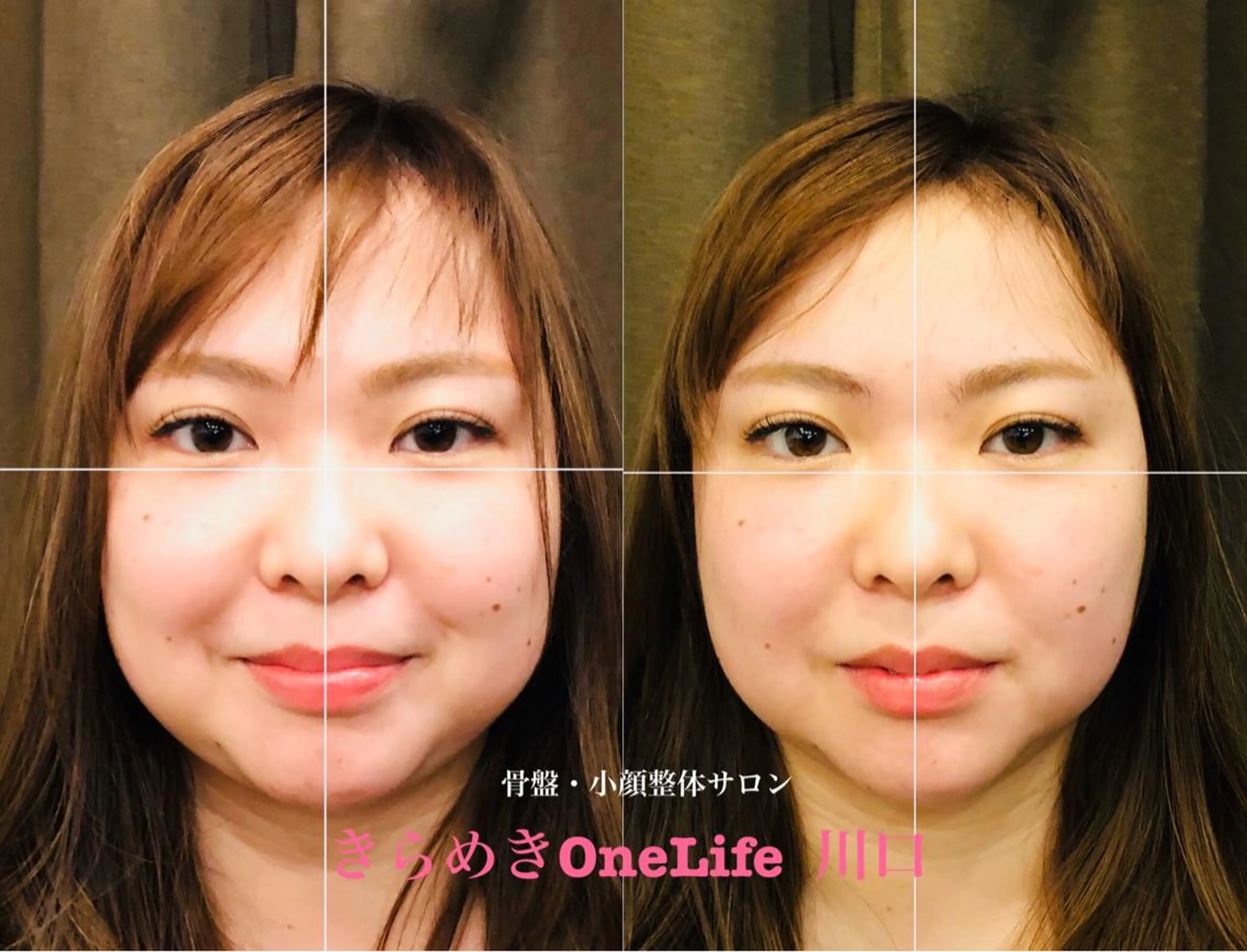 エステ リラク きらめきワンライフ Yumaのエステ・リラクイメージ