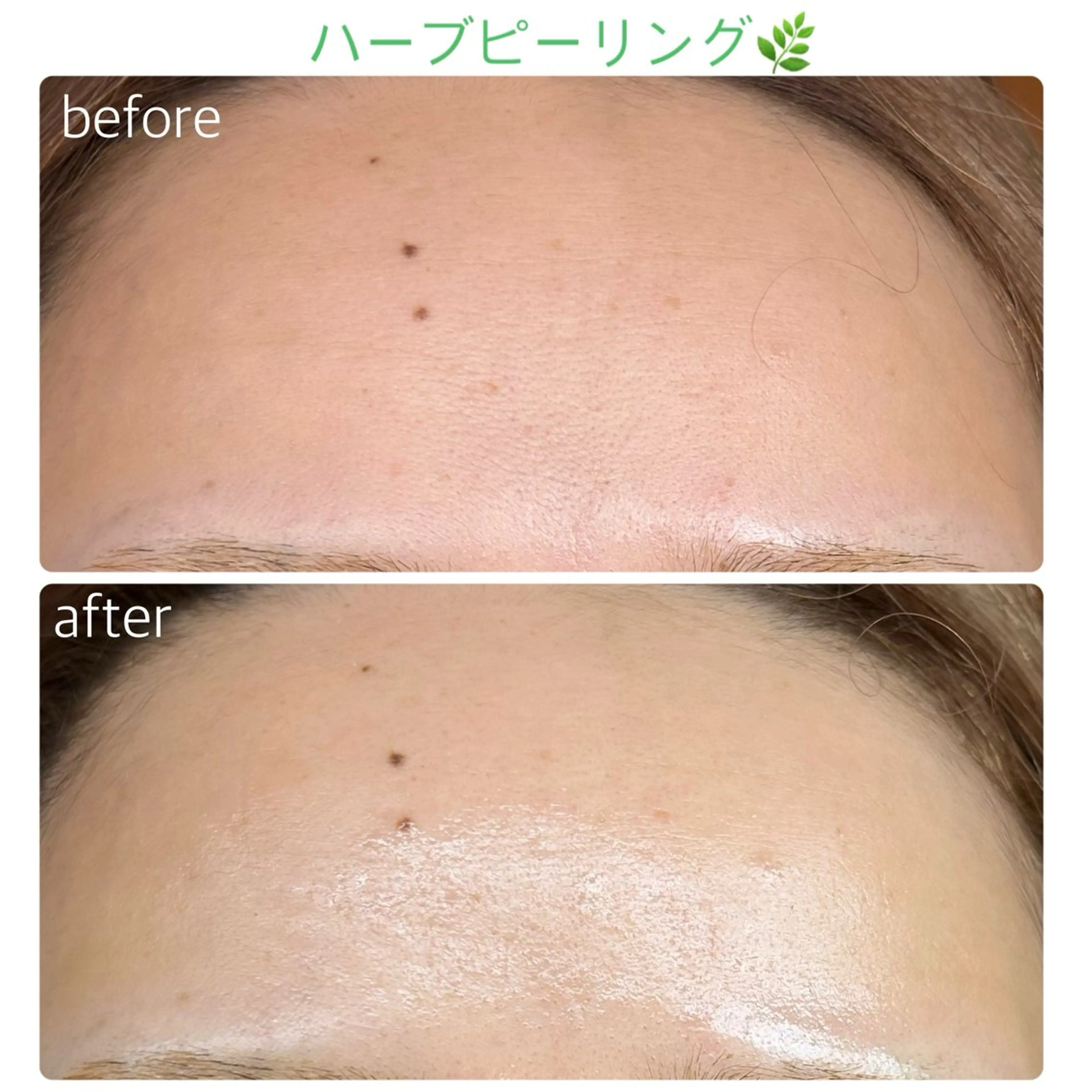 エステ soposilma 🧸今季OPENのマツエク・マツパデザイン