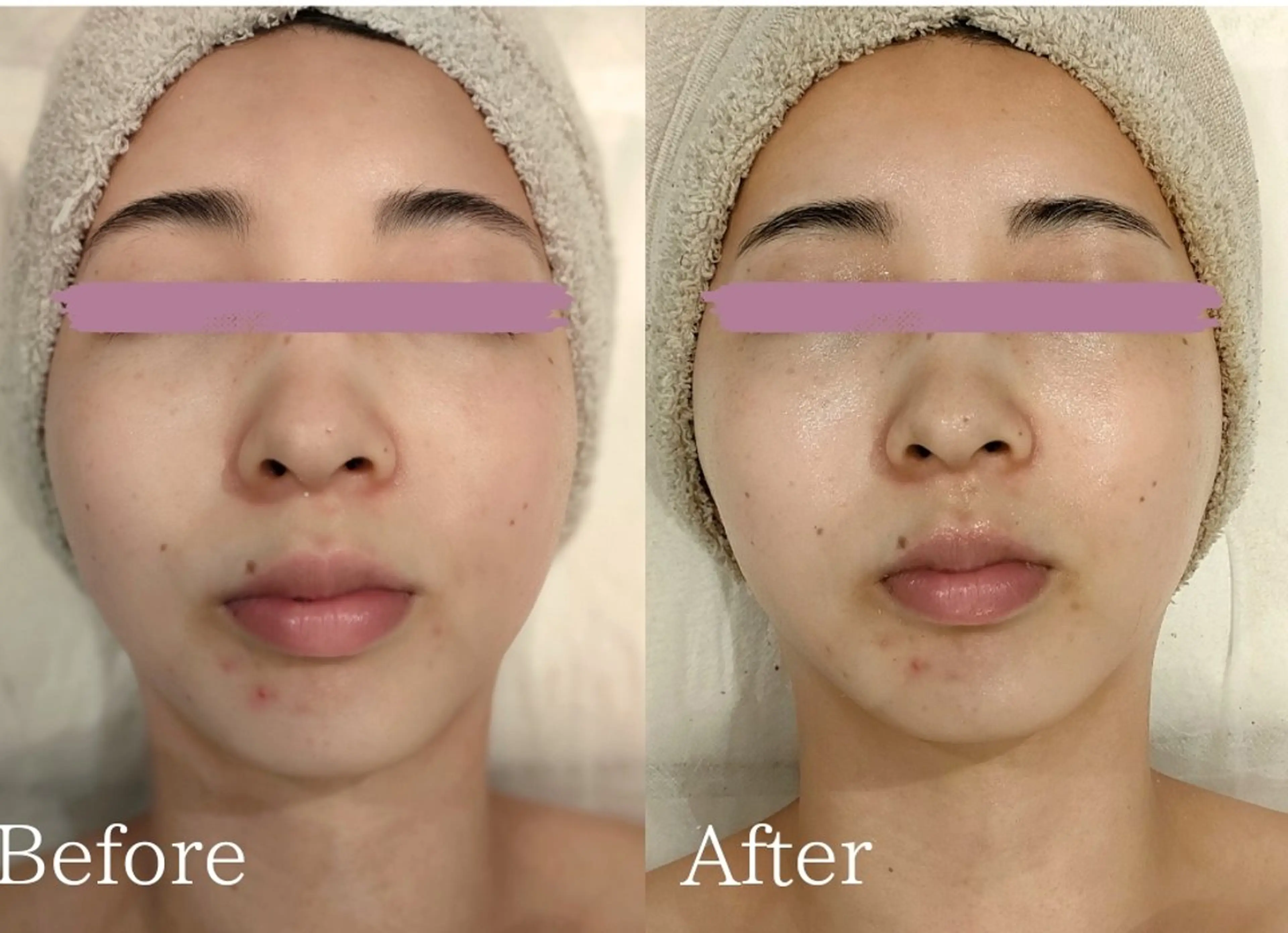 エステ 美肌脱毛＆小顔・フェ イシャル【SONA】のエステ・リラクイメージ