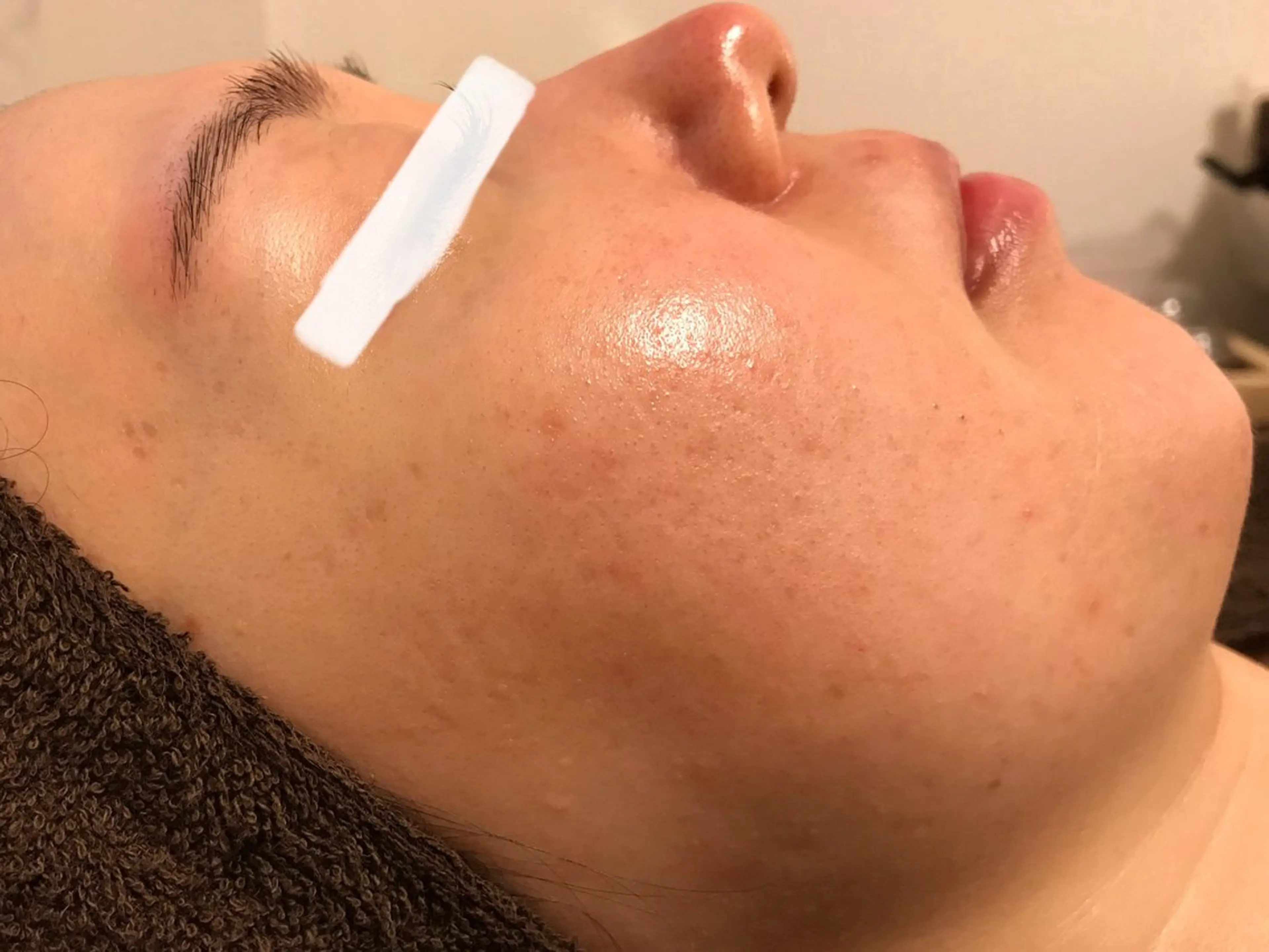 ピーリングサロン シャンテールのエステ・リラクイメージ