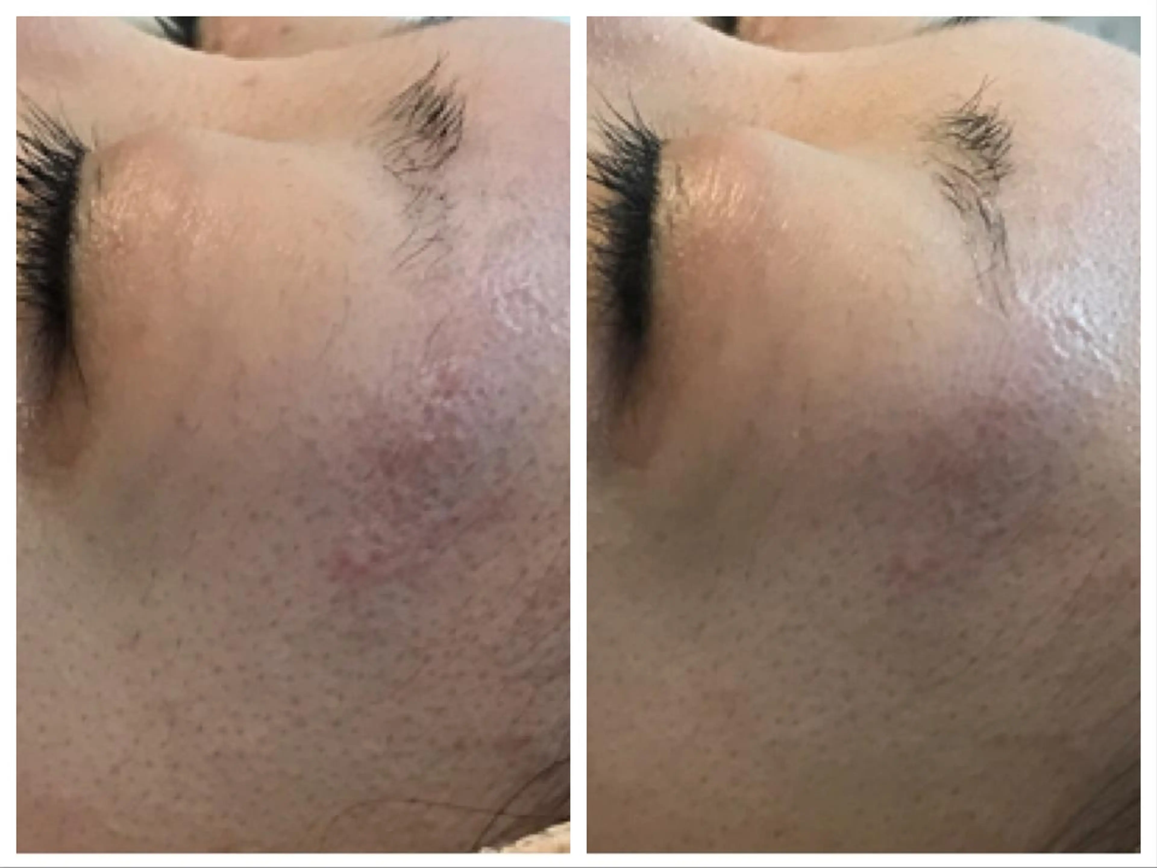 セレーネボーテプラス所属・セレーネボーテプラス ローマピンク福岡のエステ・リラクイメージ