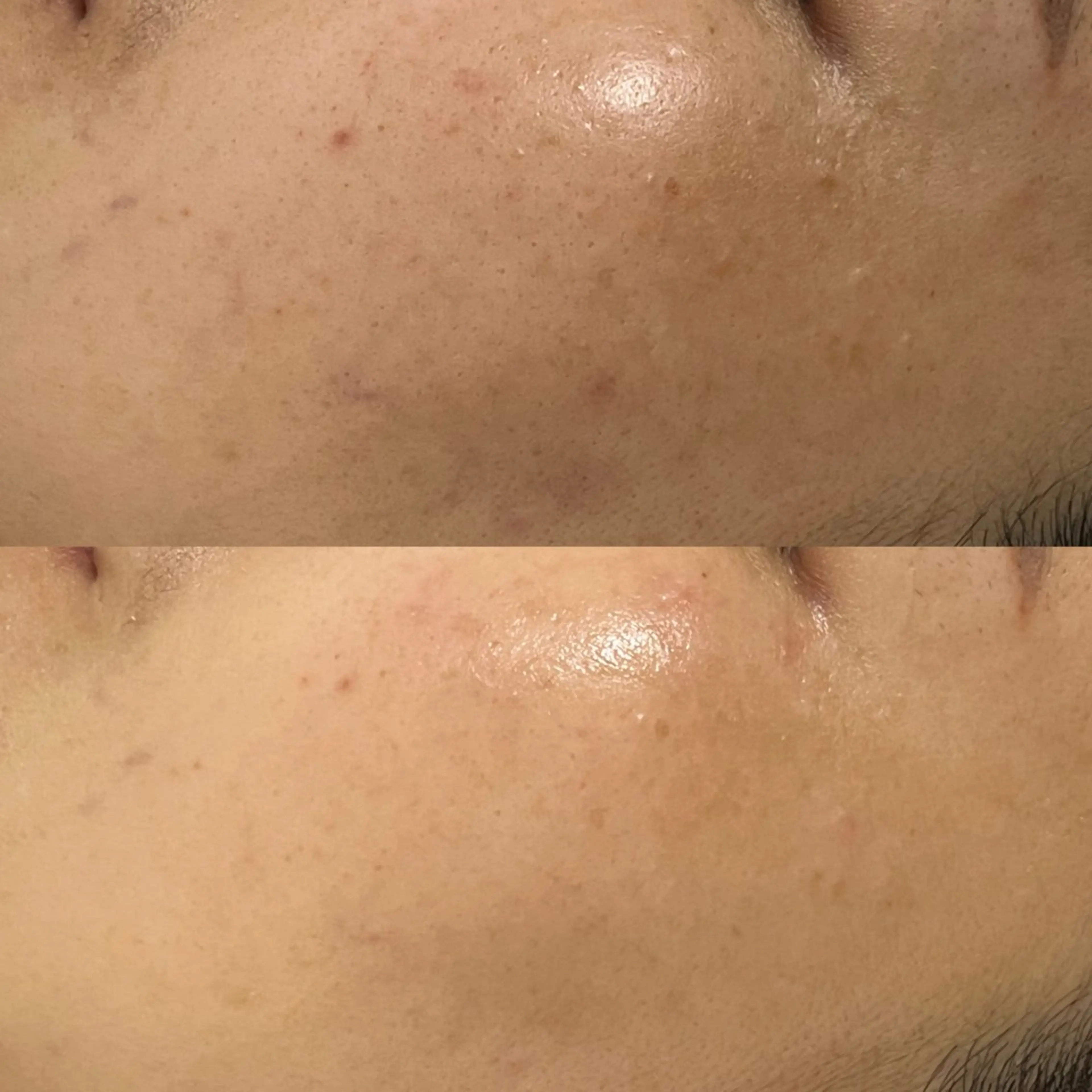 エステ Rifuro毛穴ケア &よもぎ蒸しサロンのエステ・リラクイメージ