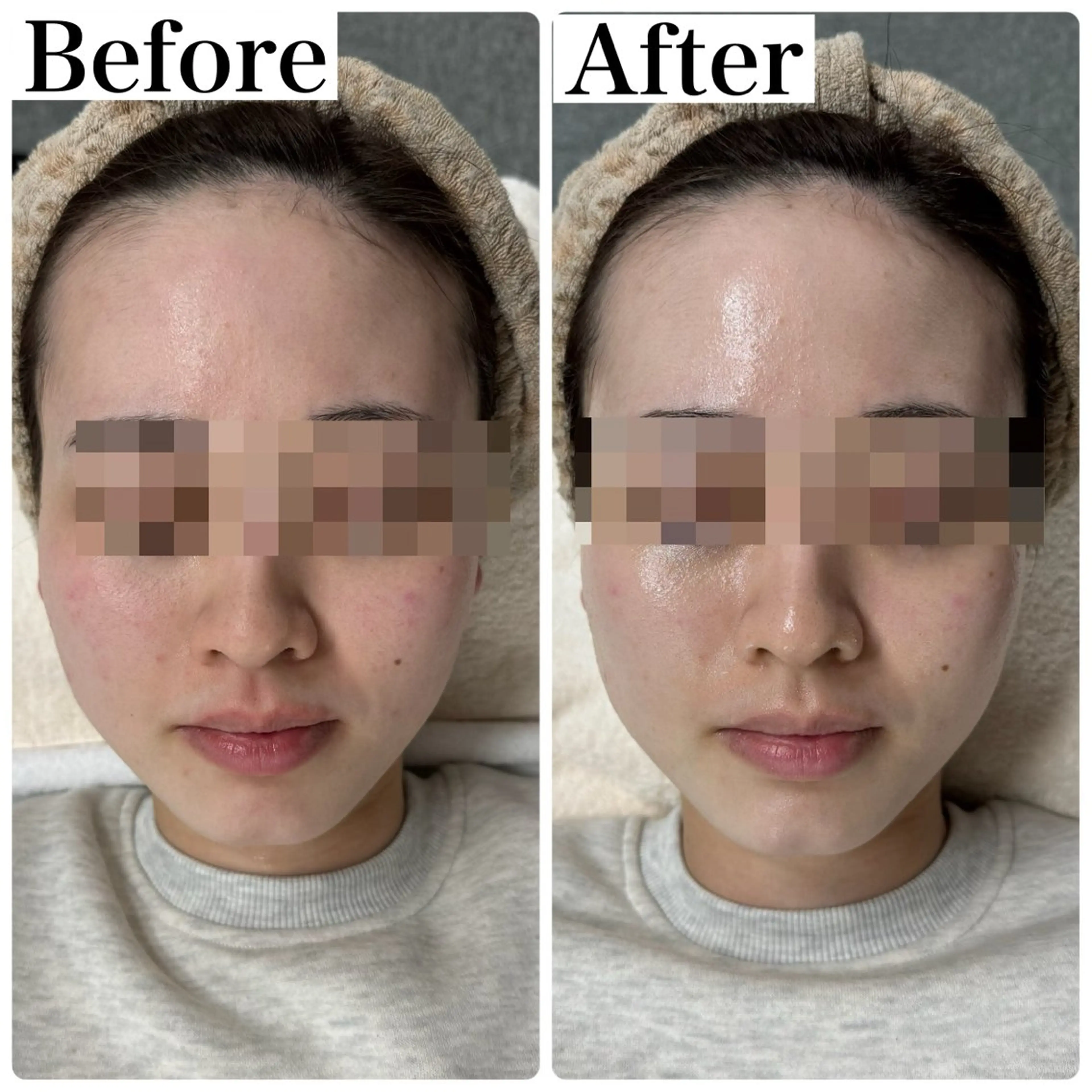 脱毛&フェイシャル 専門店muro.のエステ・リラクイメージ