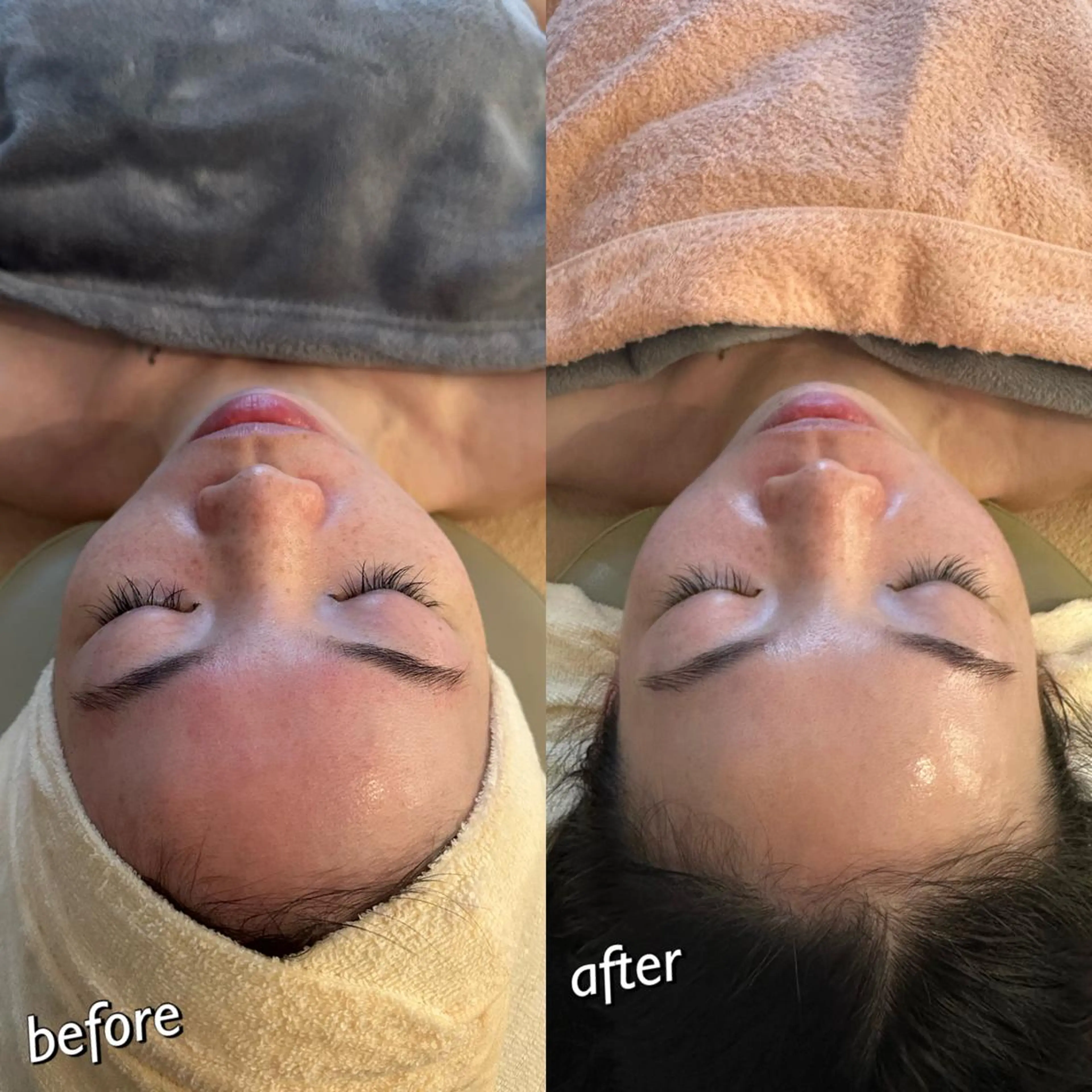 うなじ脱毛/美肌脱毛 LABELのエステ・リラクイメージ