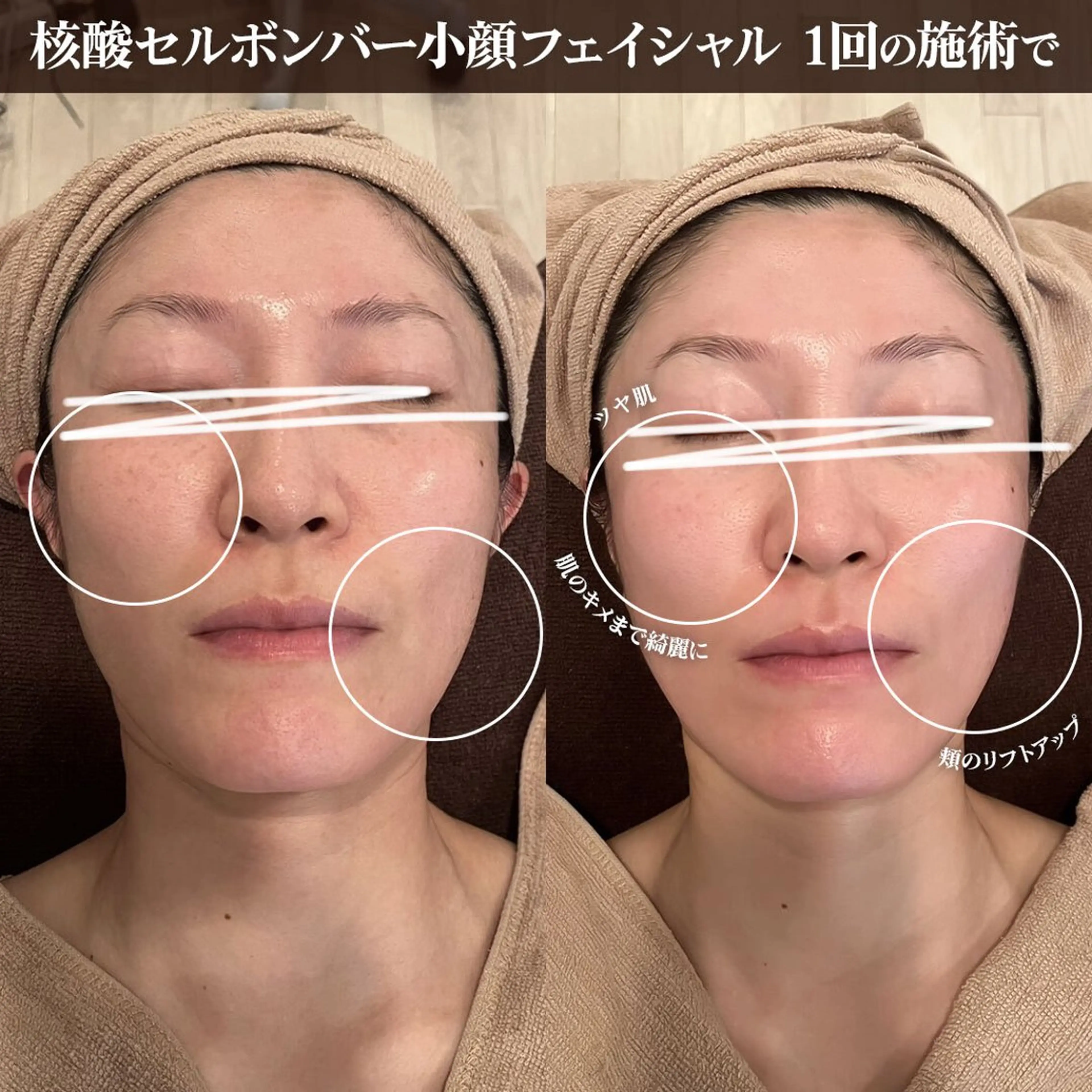 エステ リラク トータルビューティー kinoseのエステ・リラクイメージ