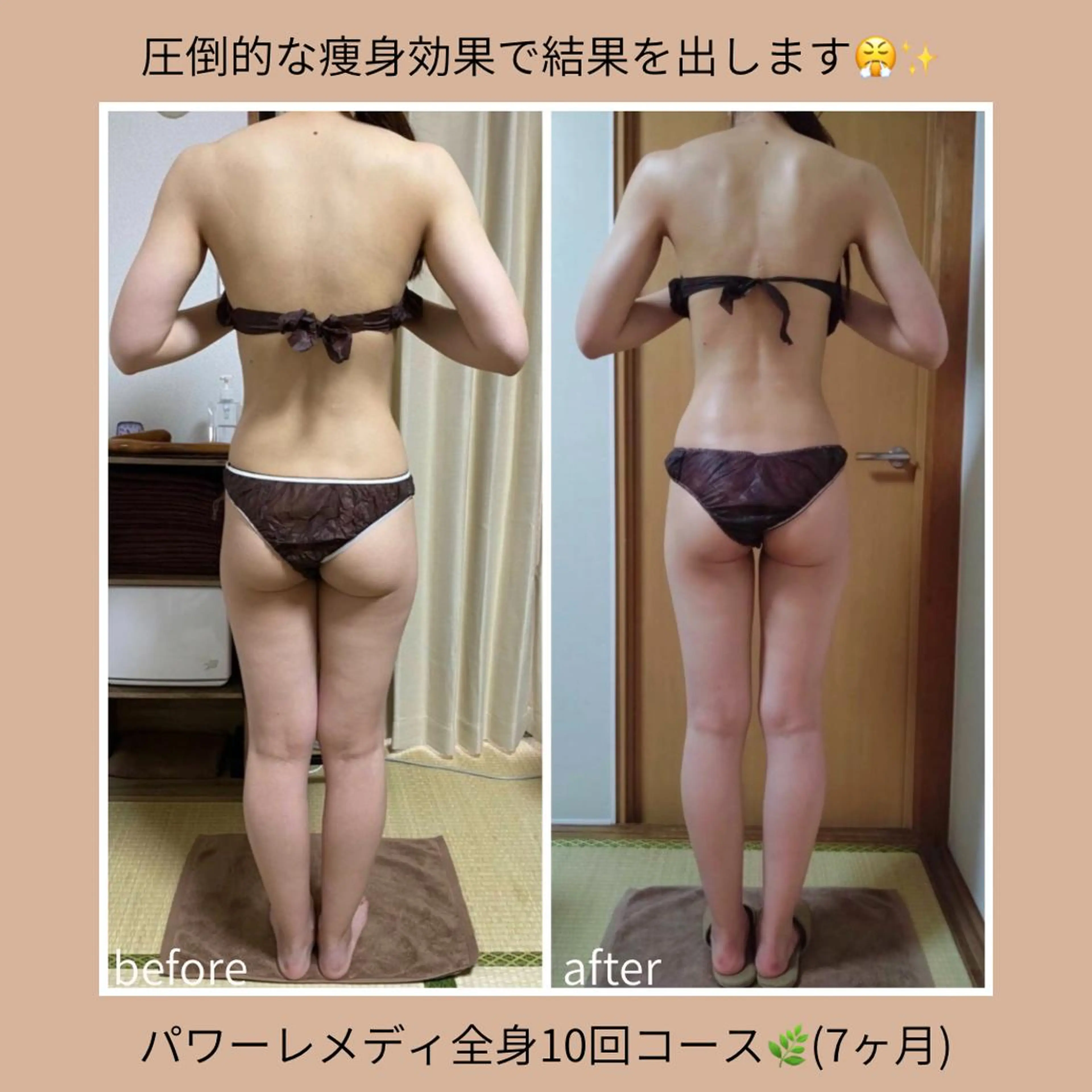 biloop所属・《本気痩せ×疲労改善 》  BILOOPのエステ・リラクイメージ