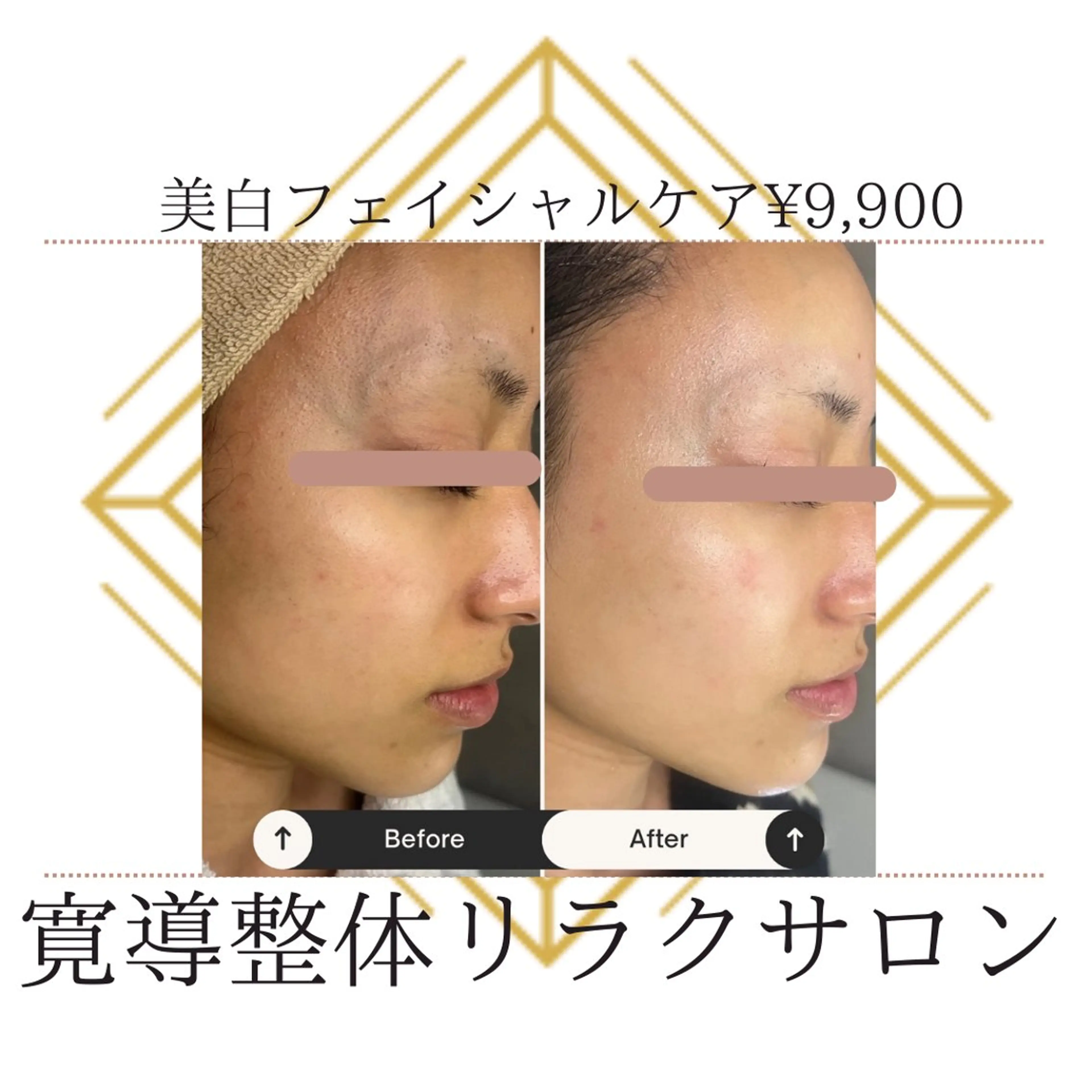 美肌フェイシャルケア😊しわたるみ➕毛穴レスの写真