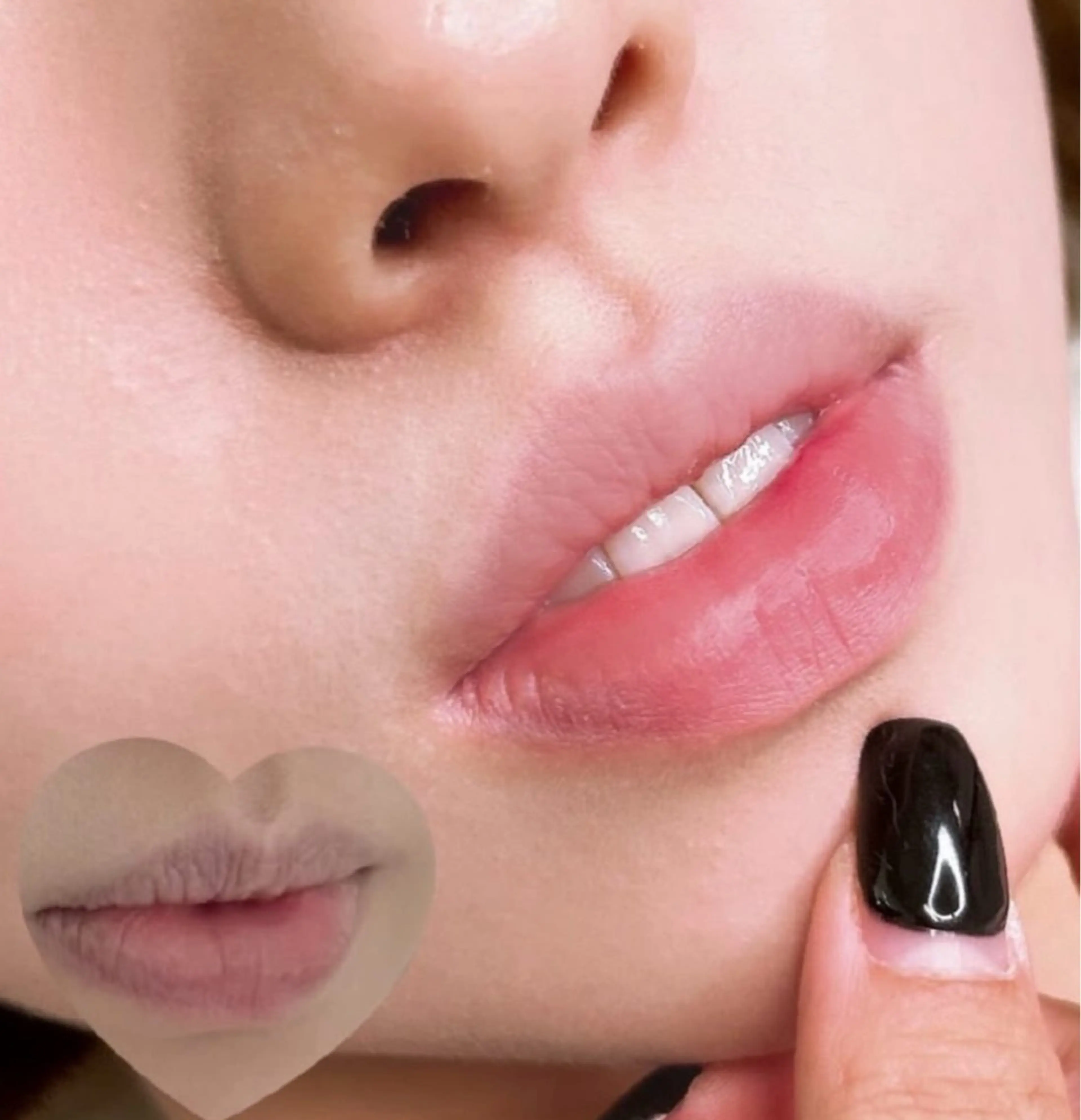 小顔/たるみ/黒ずみ除去専門サロン/SONA 大和西大寺店所属・【小顔専門看護師 サロンSONA】のエステ・リラクイメージ