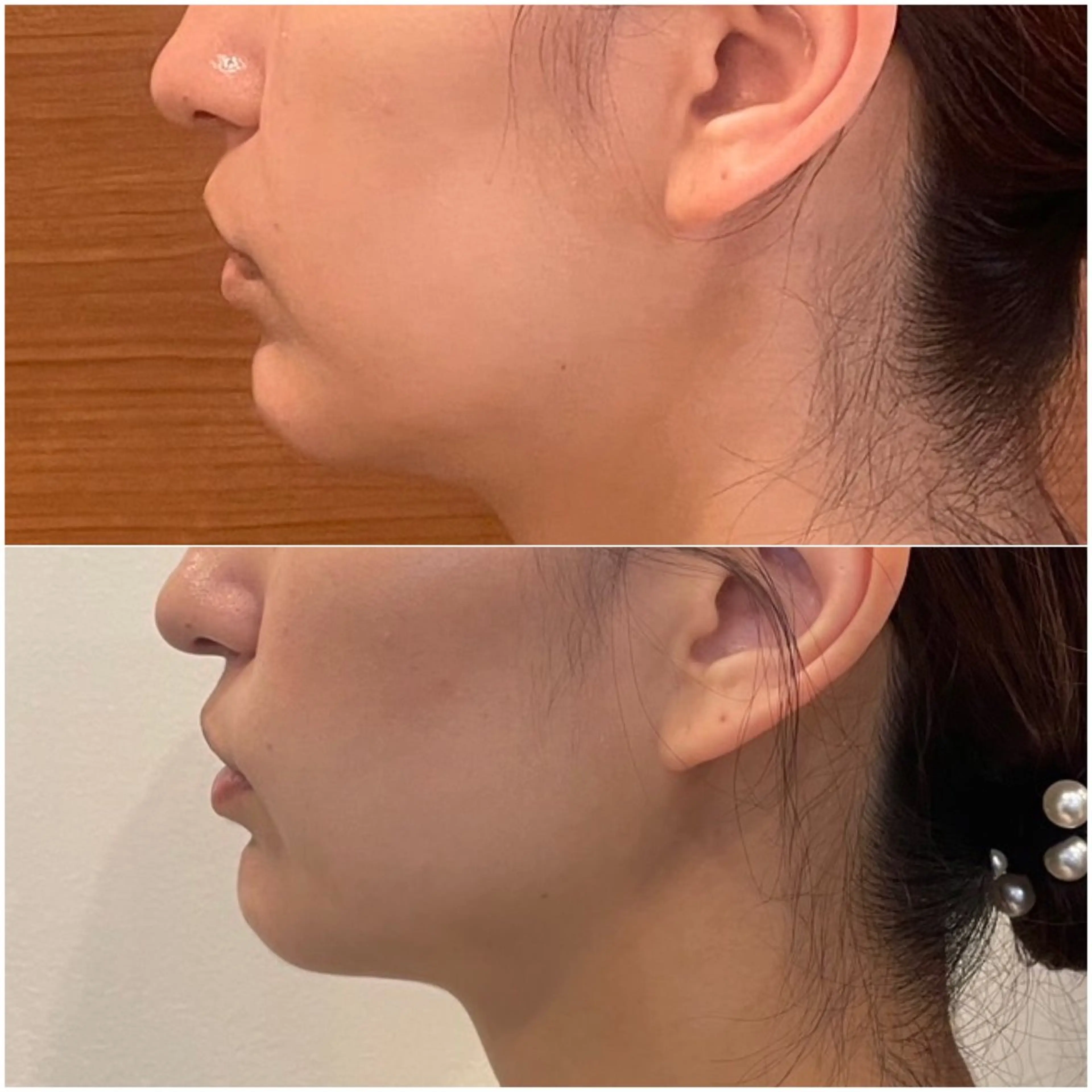 Chio-RE所属・Wax/絹肌艶肌🌼 坂結加のエステ・リラクイメージ