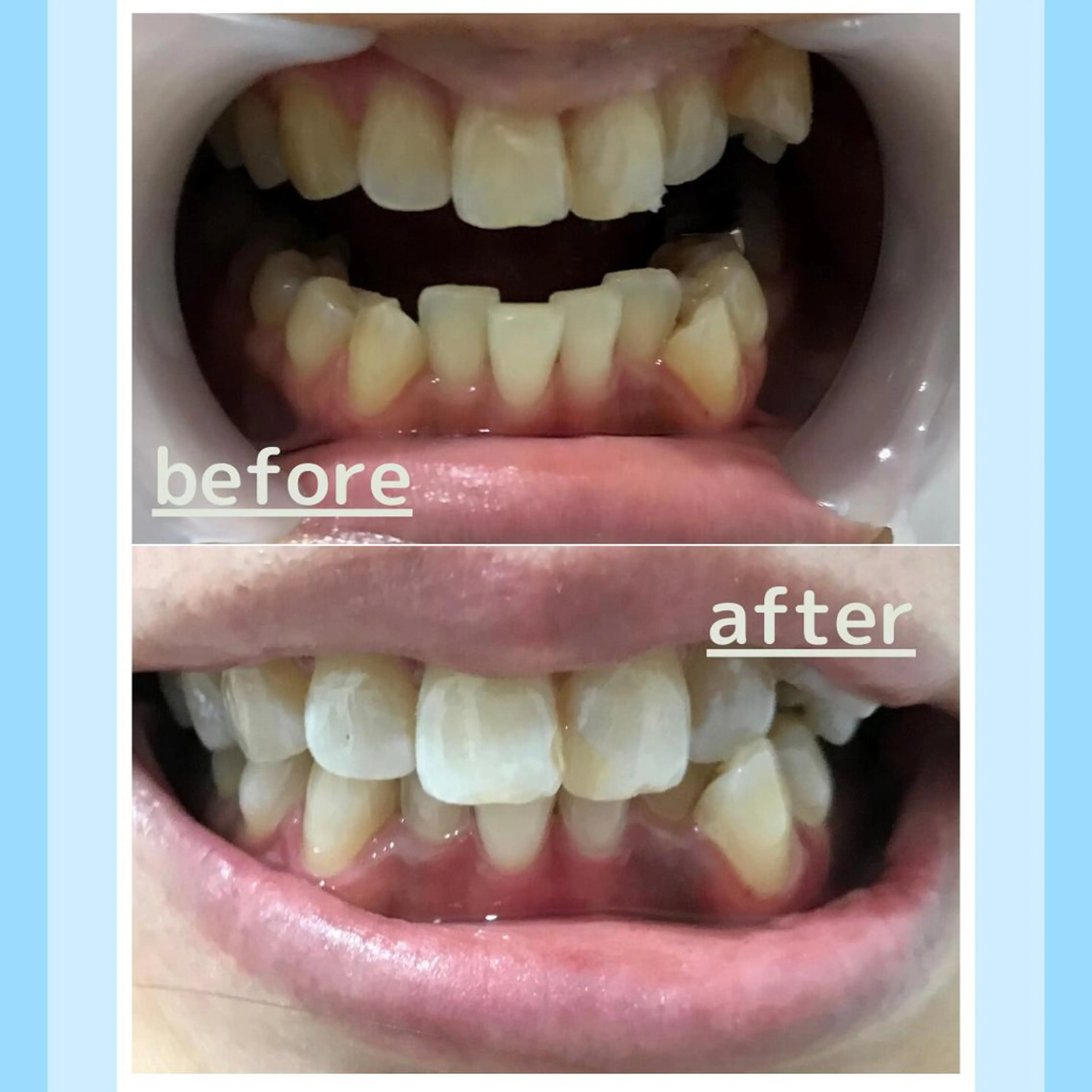 メンズ お手軽ホワイトニングsalon mina所属・武元 奈津美のその他イメージ