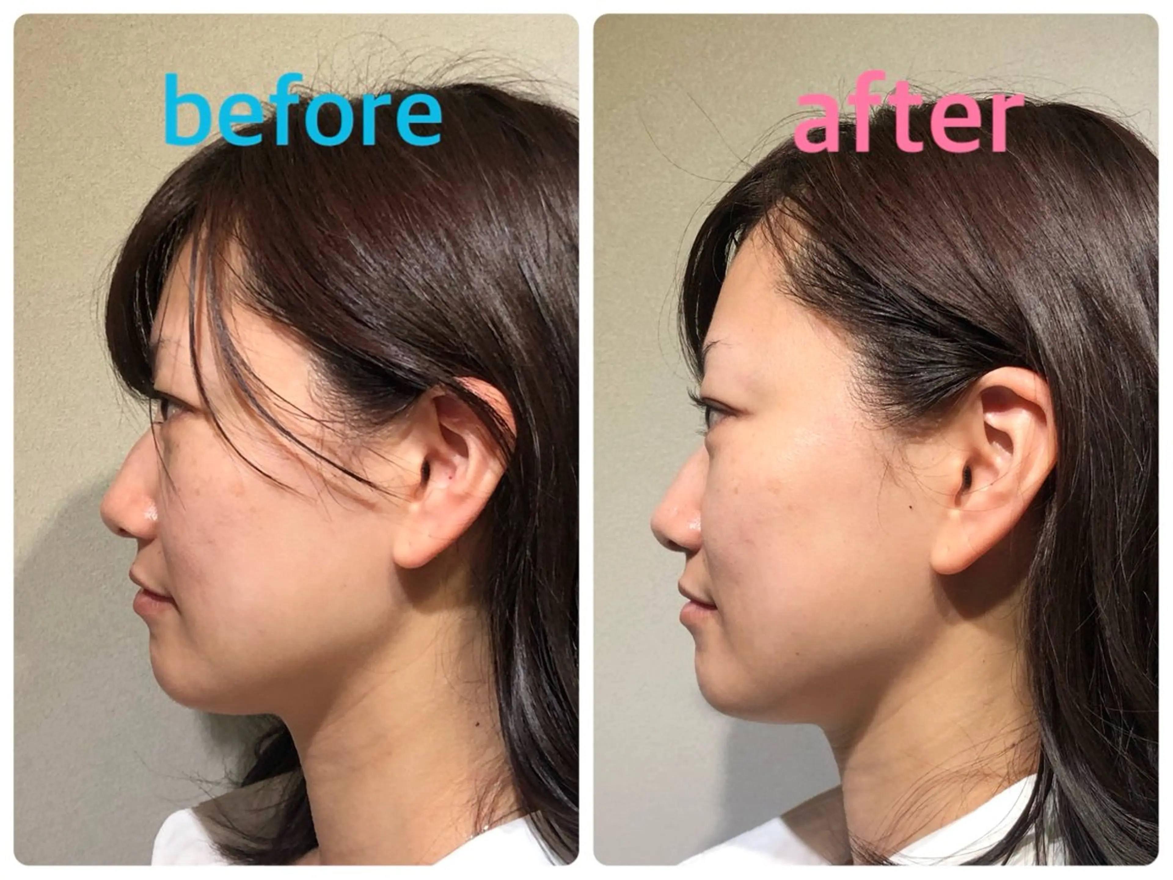 安眠ヘッドスパ美整体 🌿白金/目黒/鈴木のエステ・リラクイメージ