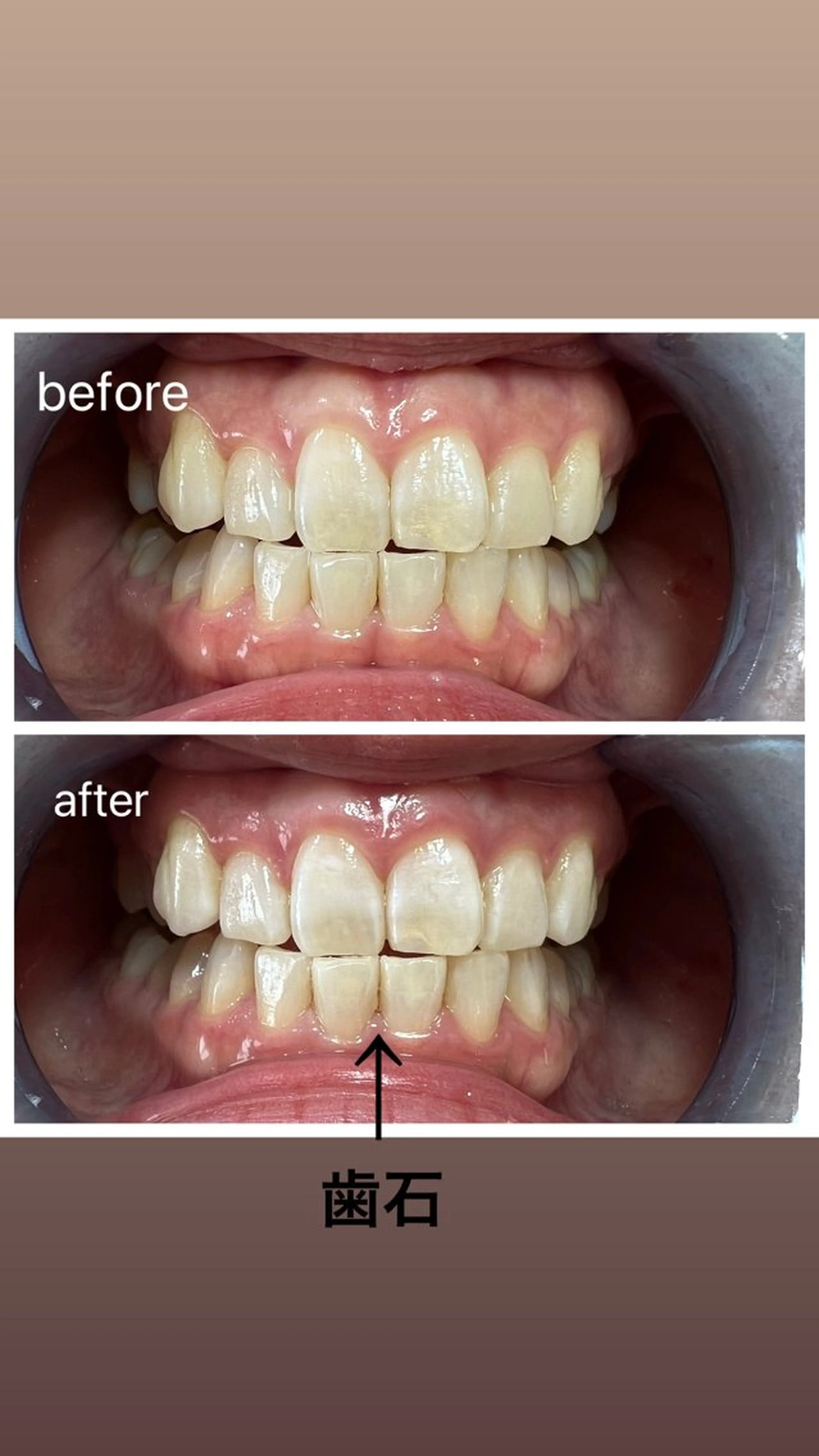 セルフホワイトニング Shineeのエステ・リラクイメージ