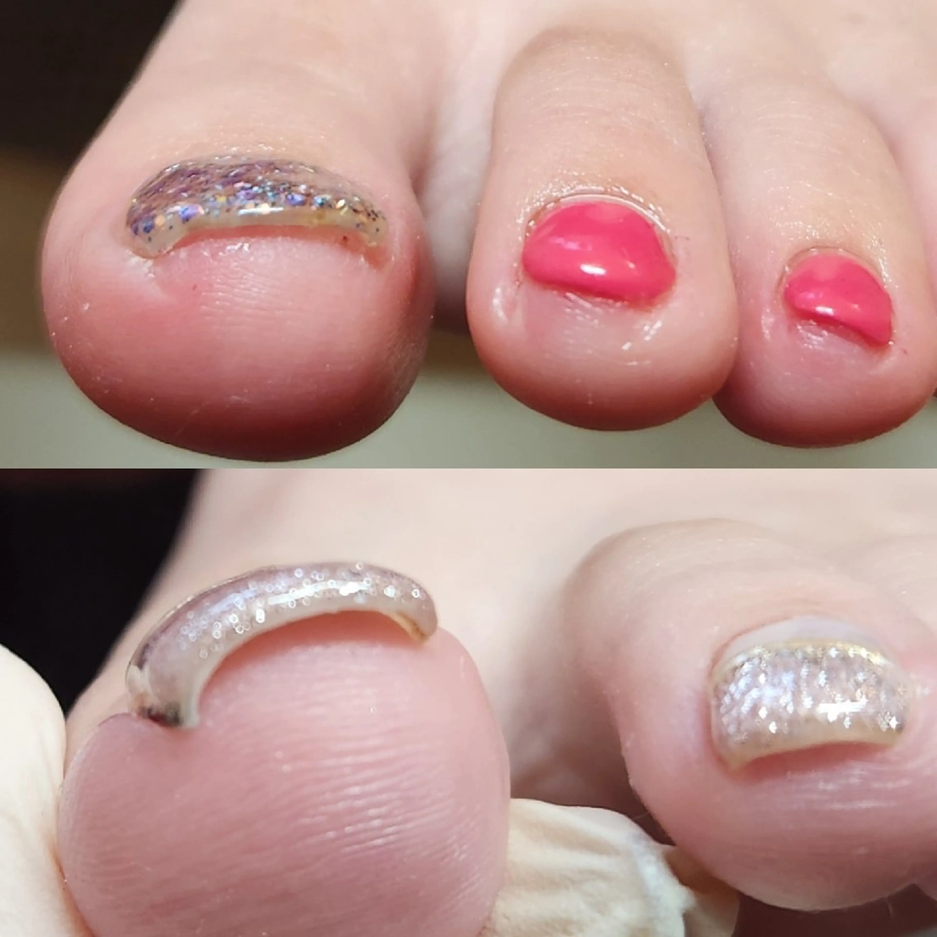 ネイル ジェルネイル Micky nail chikushinoのネイルデザイン