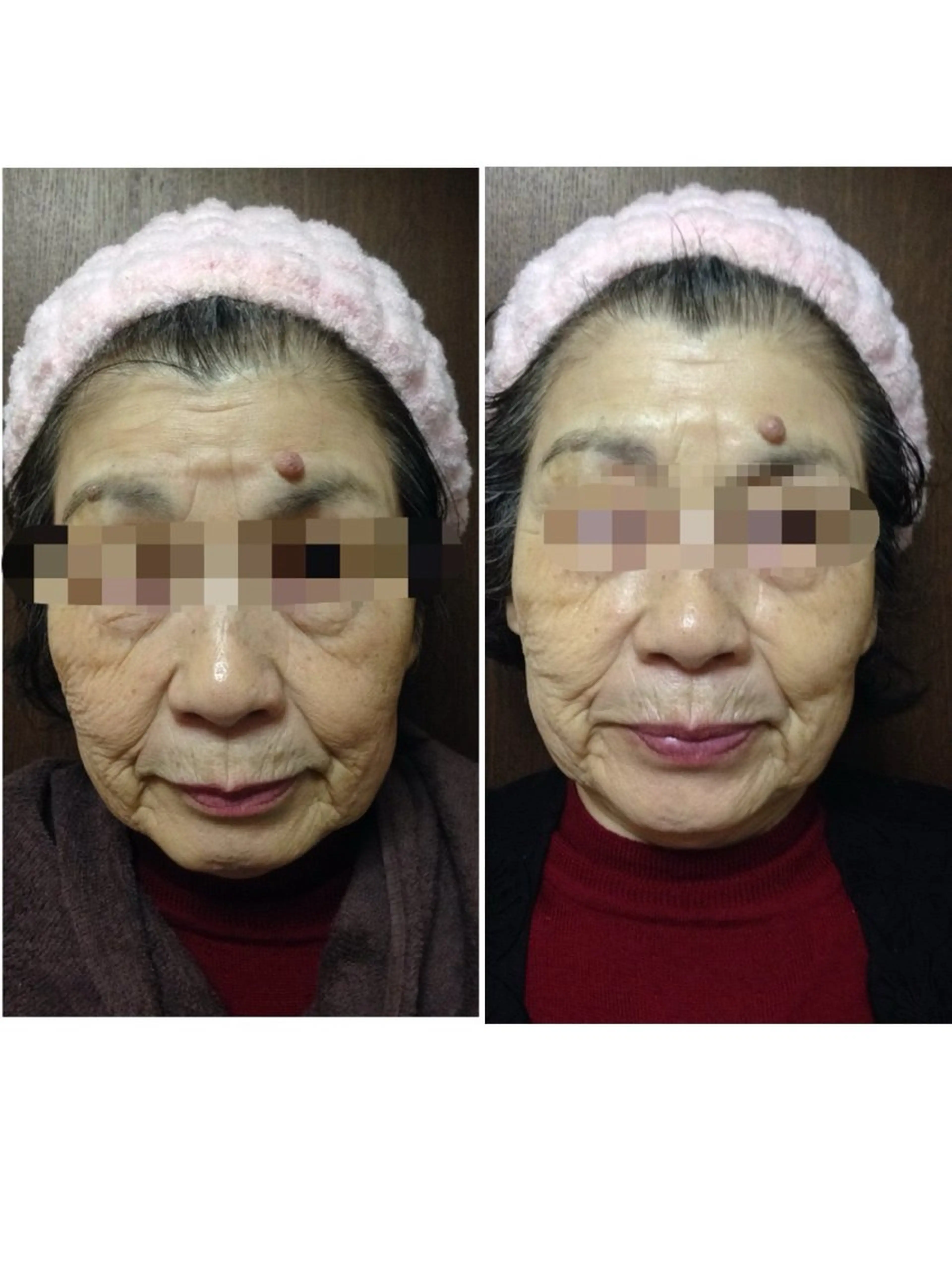 Lussera(ルセラ)所属・肌質を変えて すっぴん肌に✨のその他イメージ