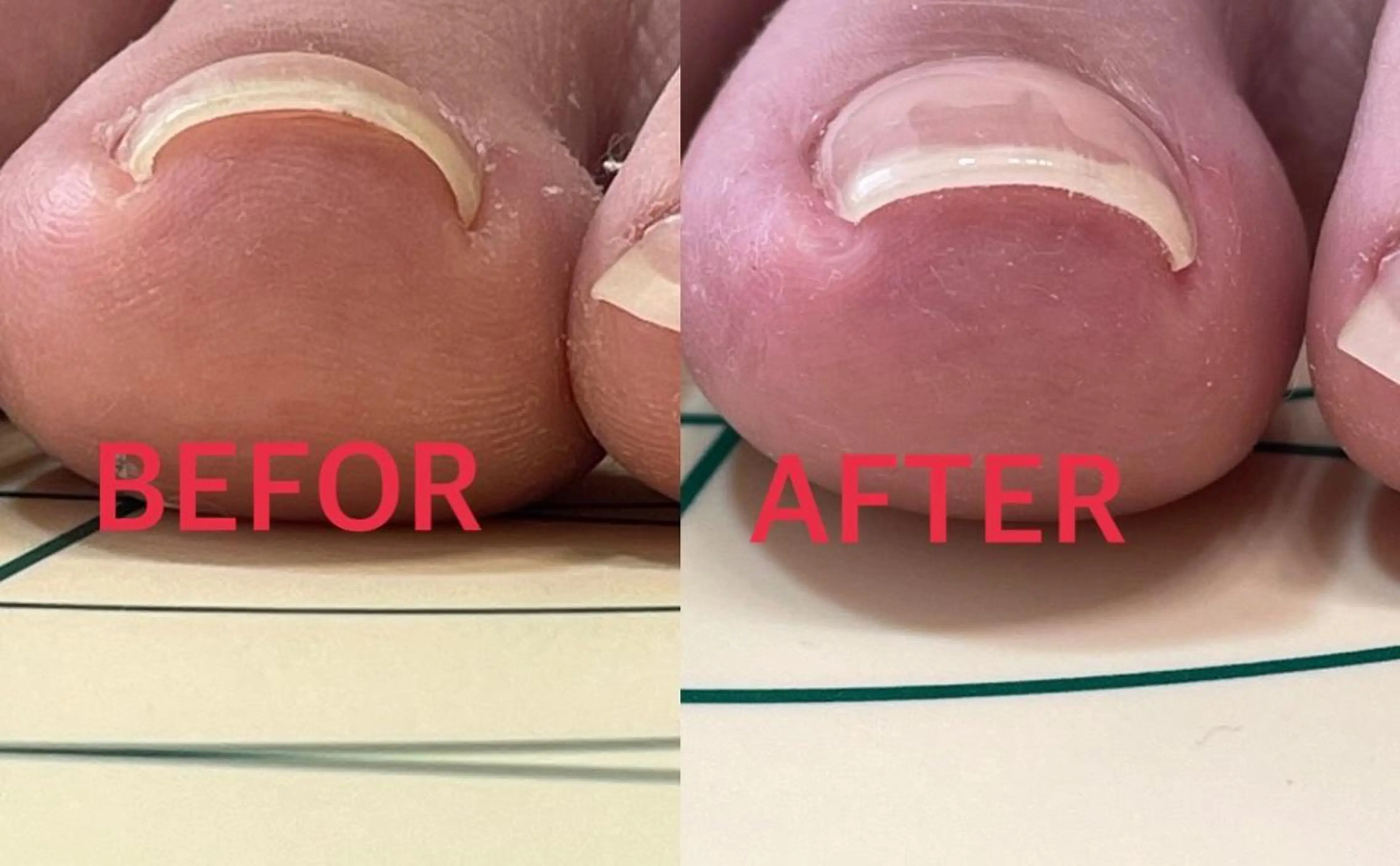 ネイル ジェルネイル 韓国ネイル フットネイル Nail Salon agré所属・agré ネイルサロン　アグレのネイルデザイン