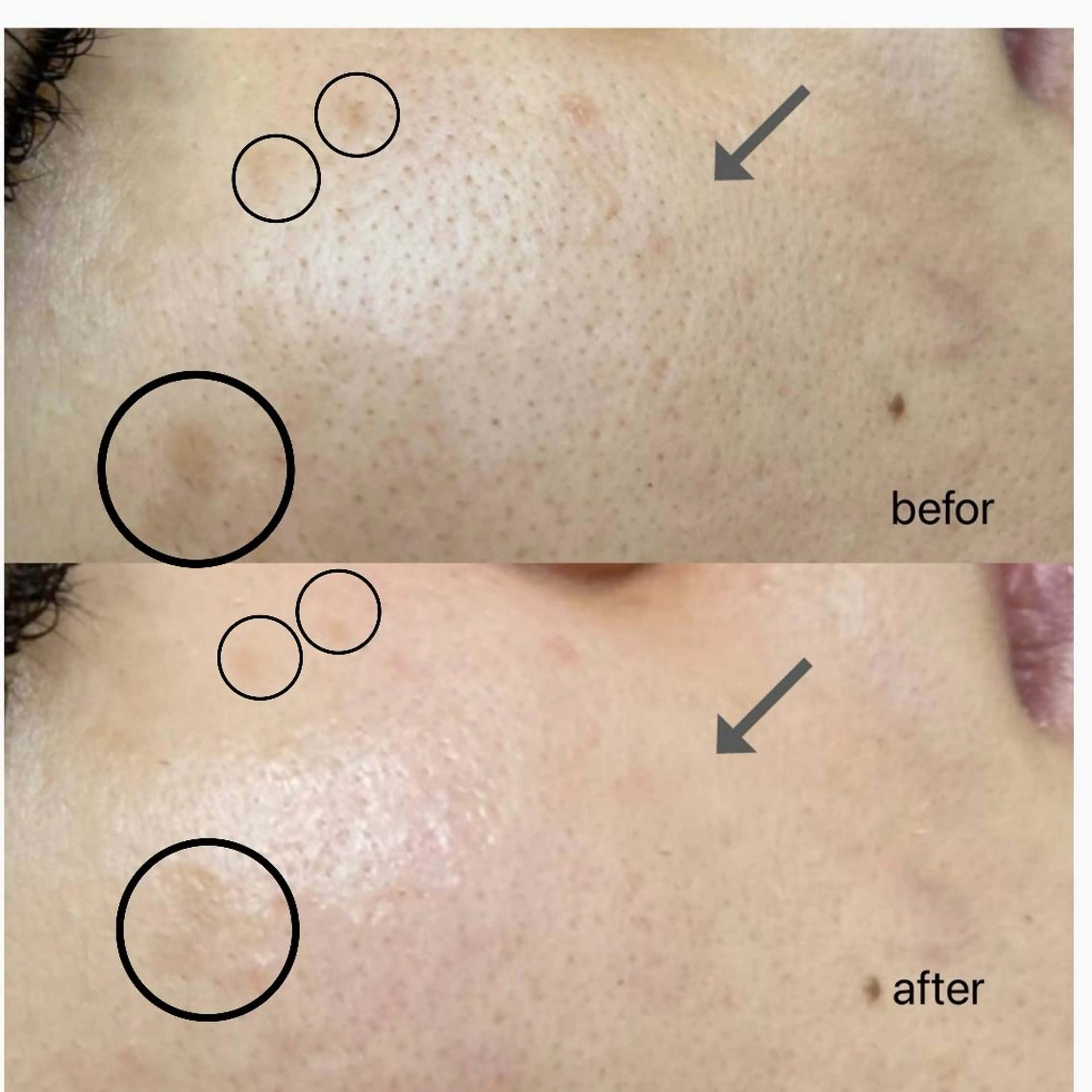 Anacia Beauty Salon所属・美肌脱毛&毛穴専門 Anaciaのエステ・リラクイメージ