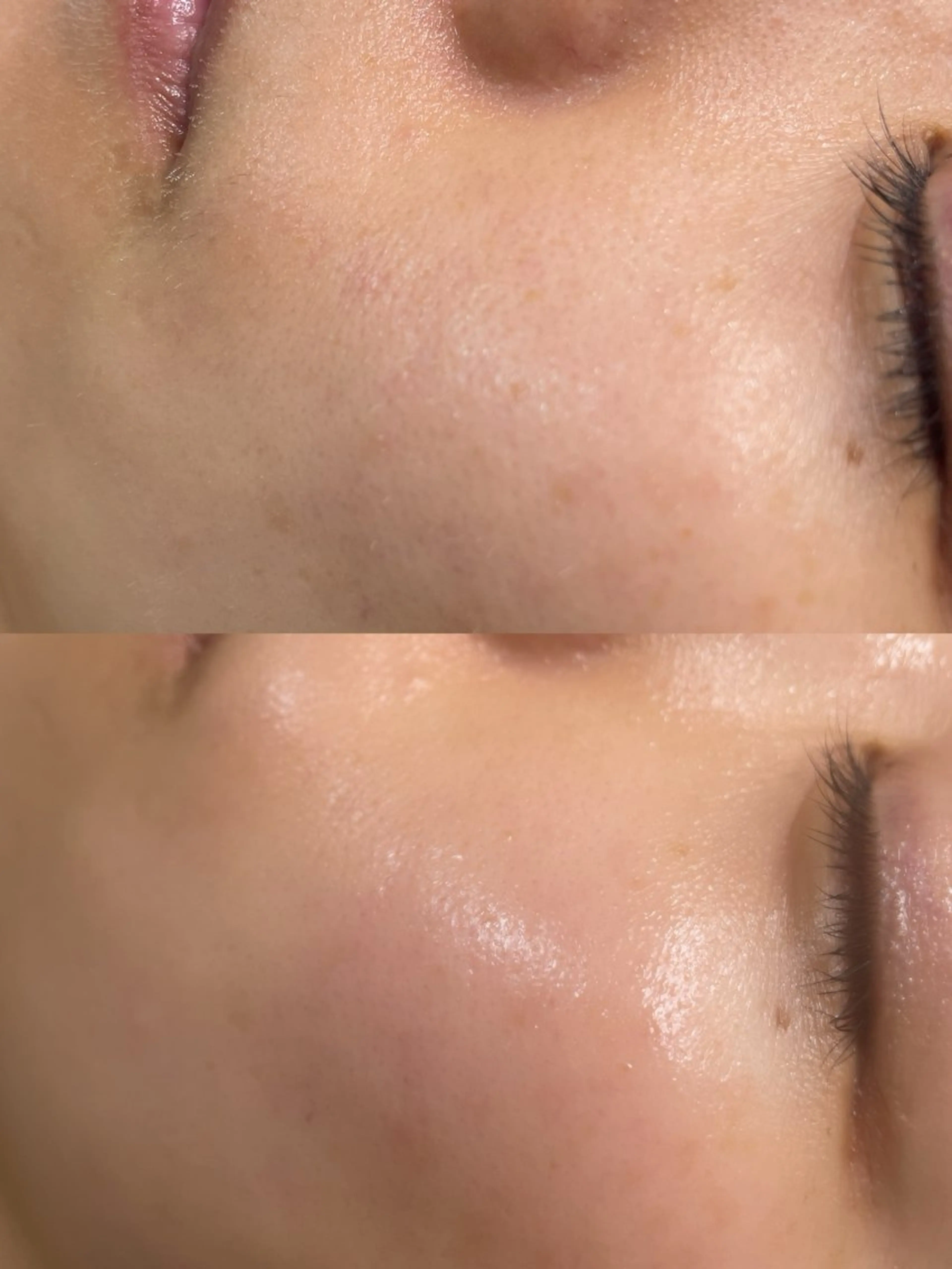 脱毛 ビューティーサロン Lino🫧mayuのエステ・リラクイメージ