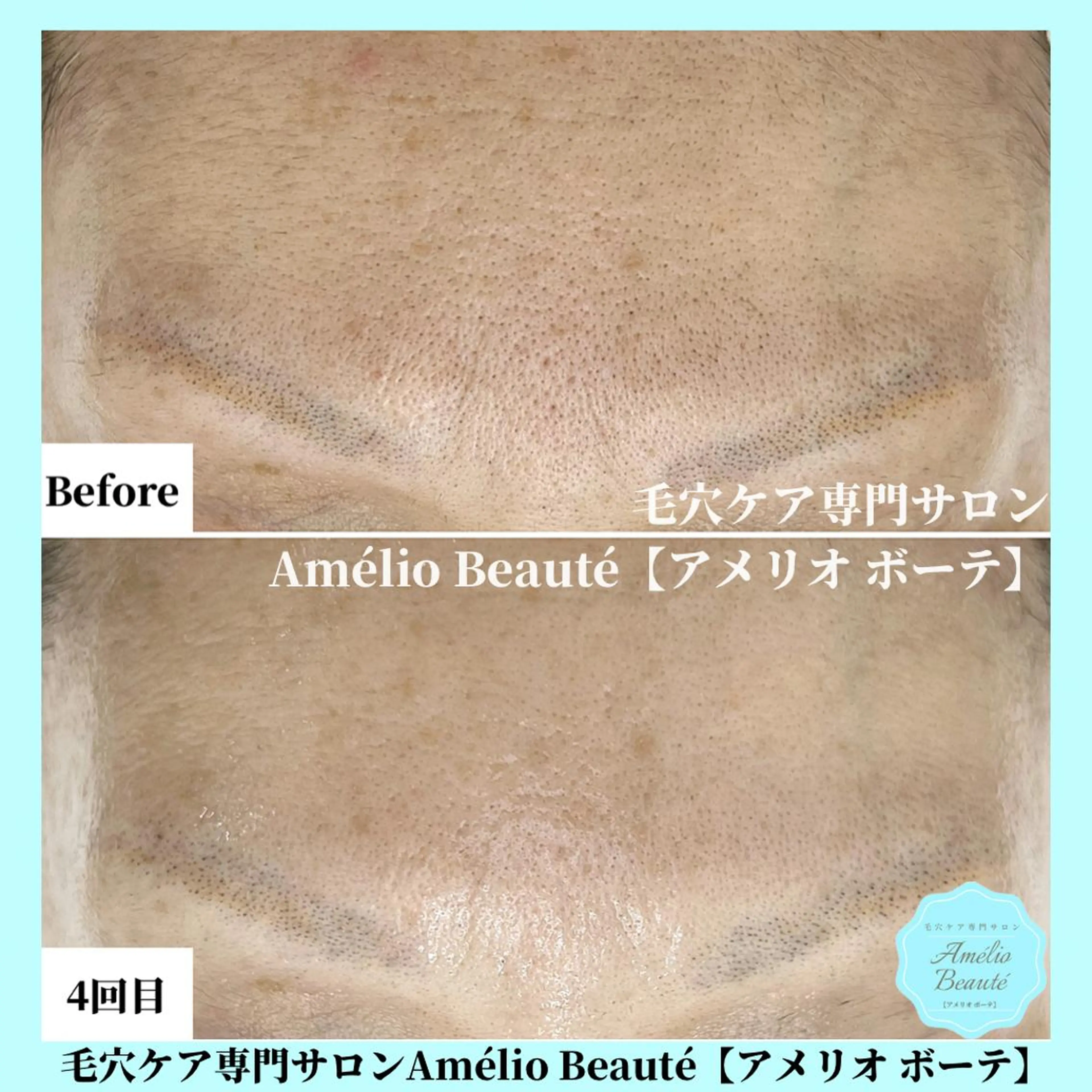 毛穴ケア専門サロン Amélio Beauté所属・毛穴ケア専門サロン アメリオボーテのその他イメージ